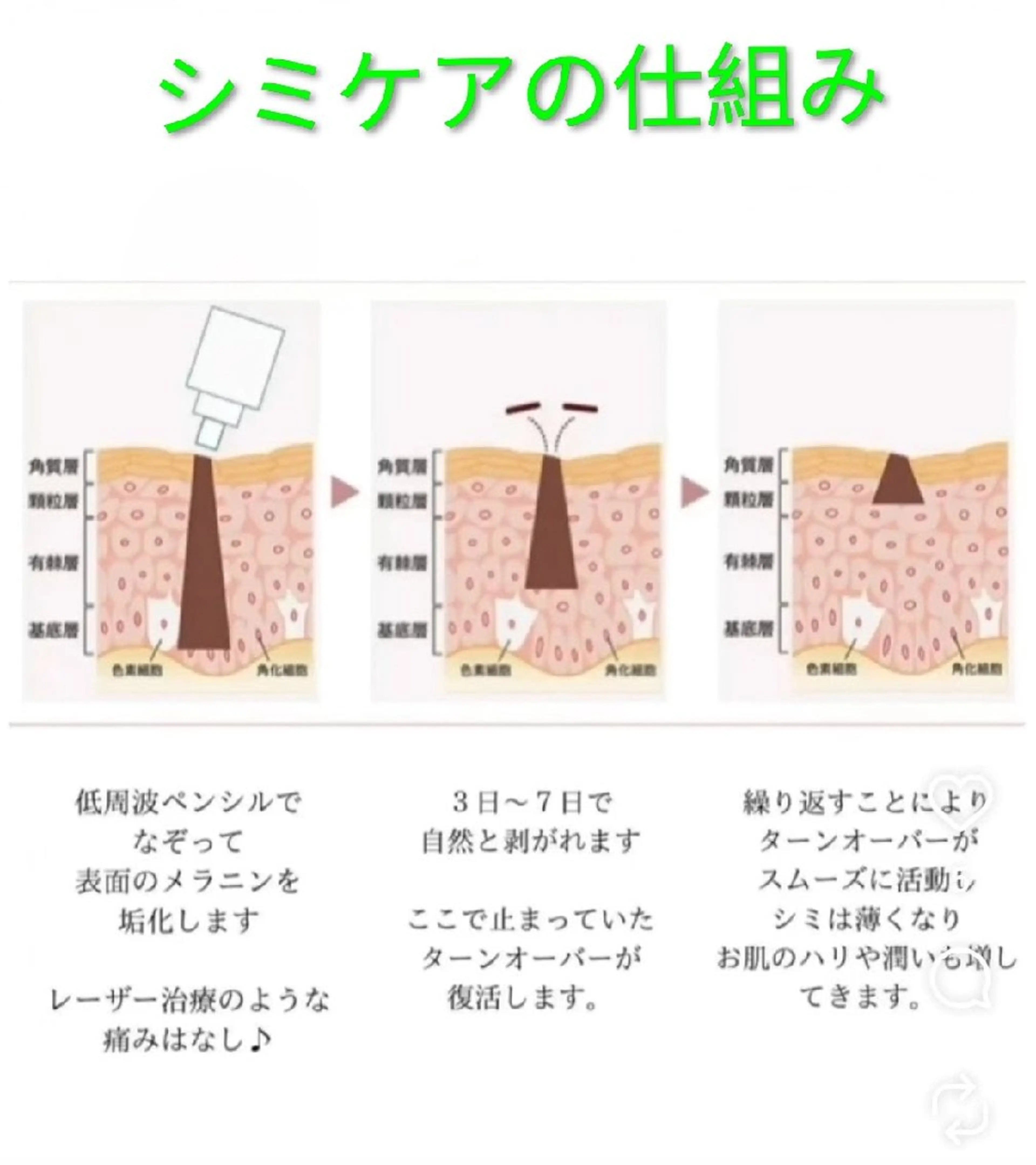 SPOT.com  シミケア専門店のエステ・リラクイメージ