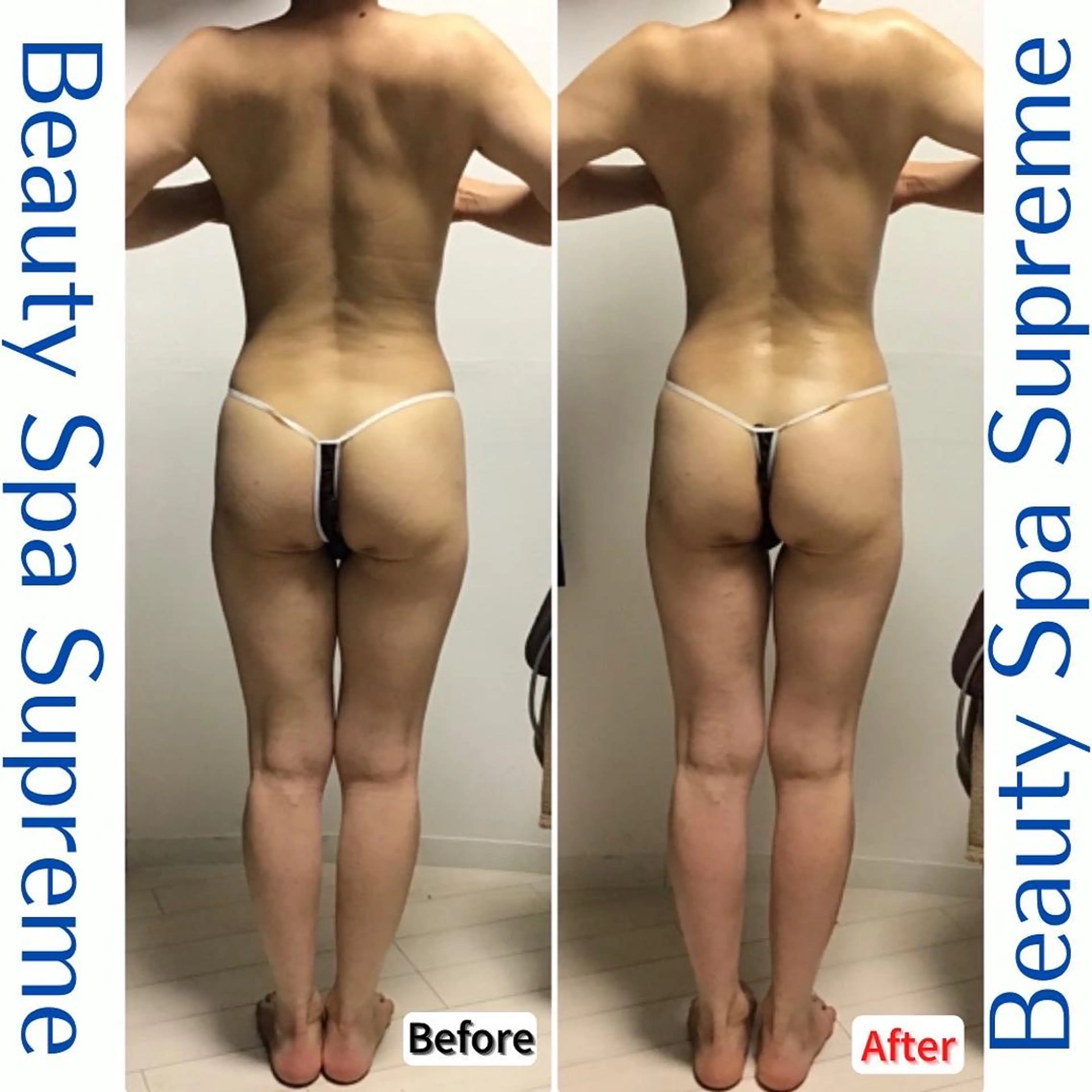 BeautySpaSupreme所属・Beauty Spa Supreme小玉のエステ・リラクイメージ