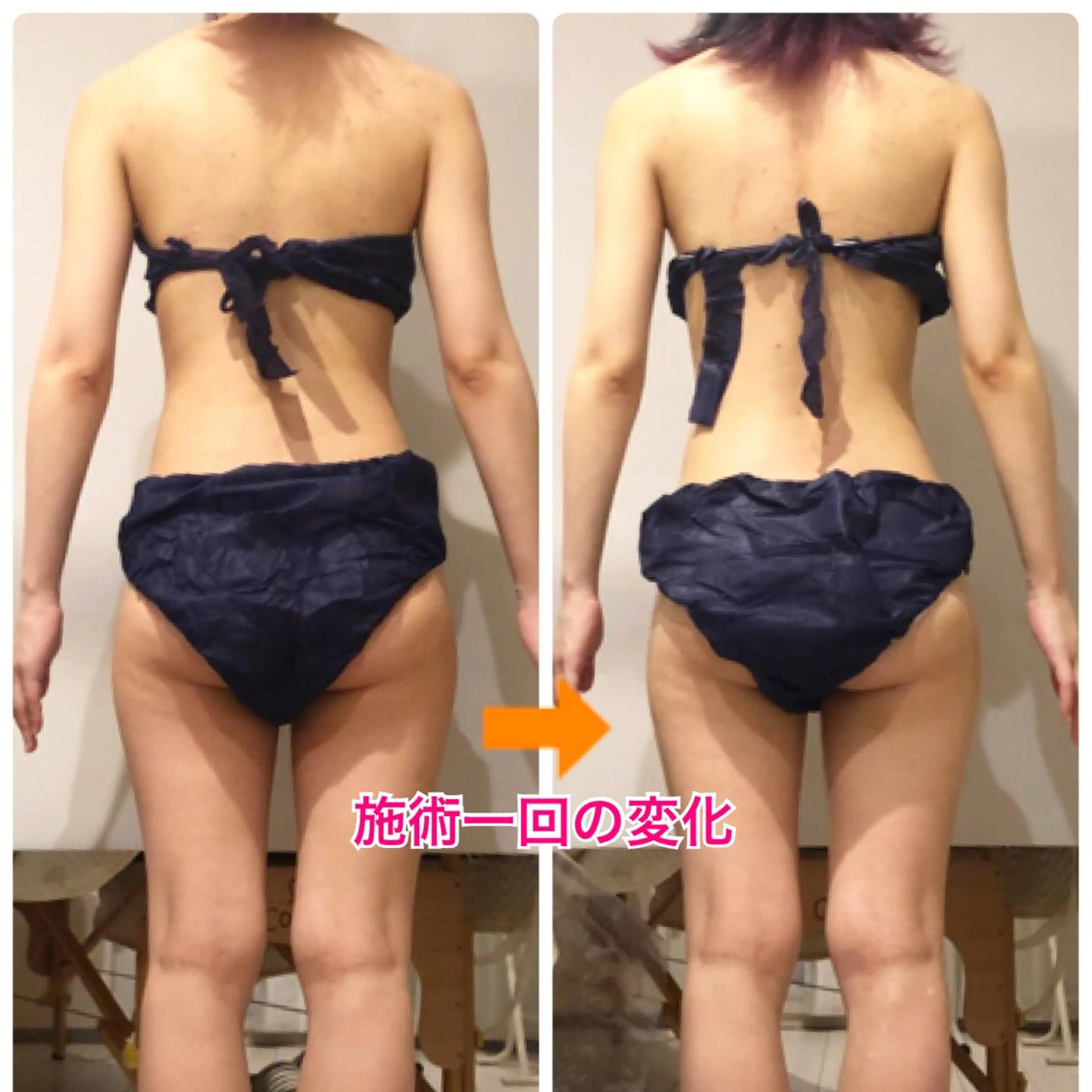 ロング カラー パーマ ヘアアレンジ メンズ キッズ ネイル マツエク・マツパ ‍痩身＆ボディ 結果出し🌟丹野のエステ・リラクイメージ