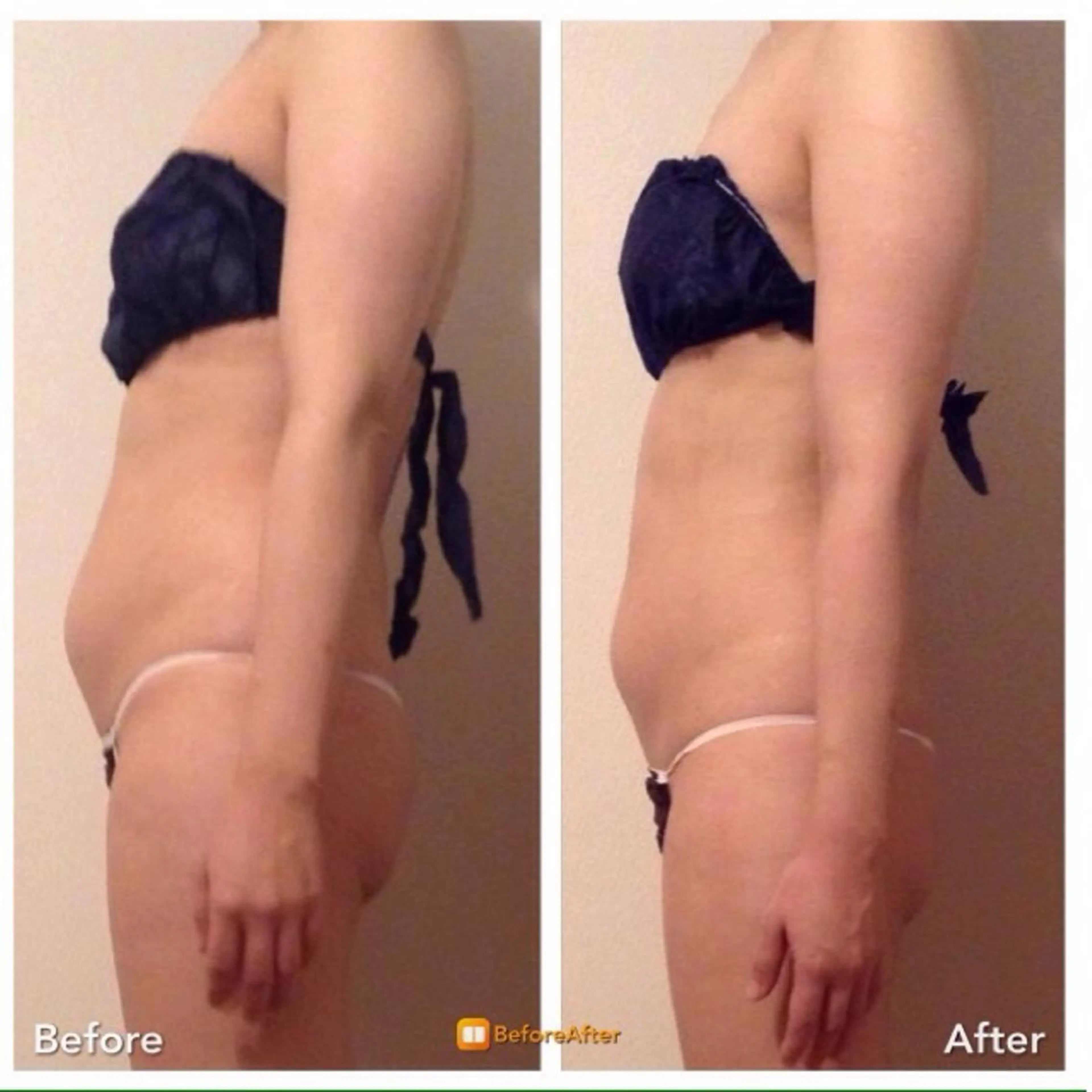 エステ リラク 小尻・太もも痩せる エステルナボーテのエステ・リラクイメージ