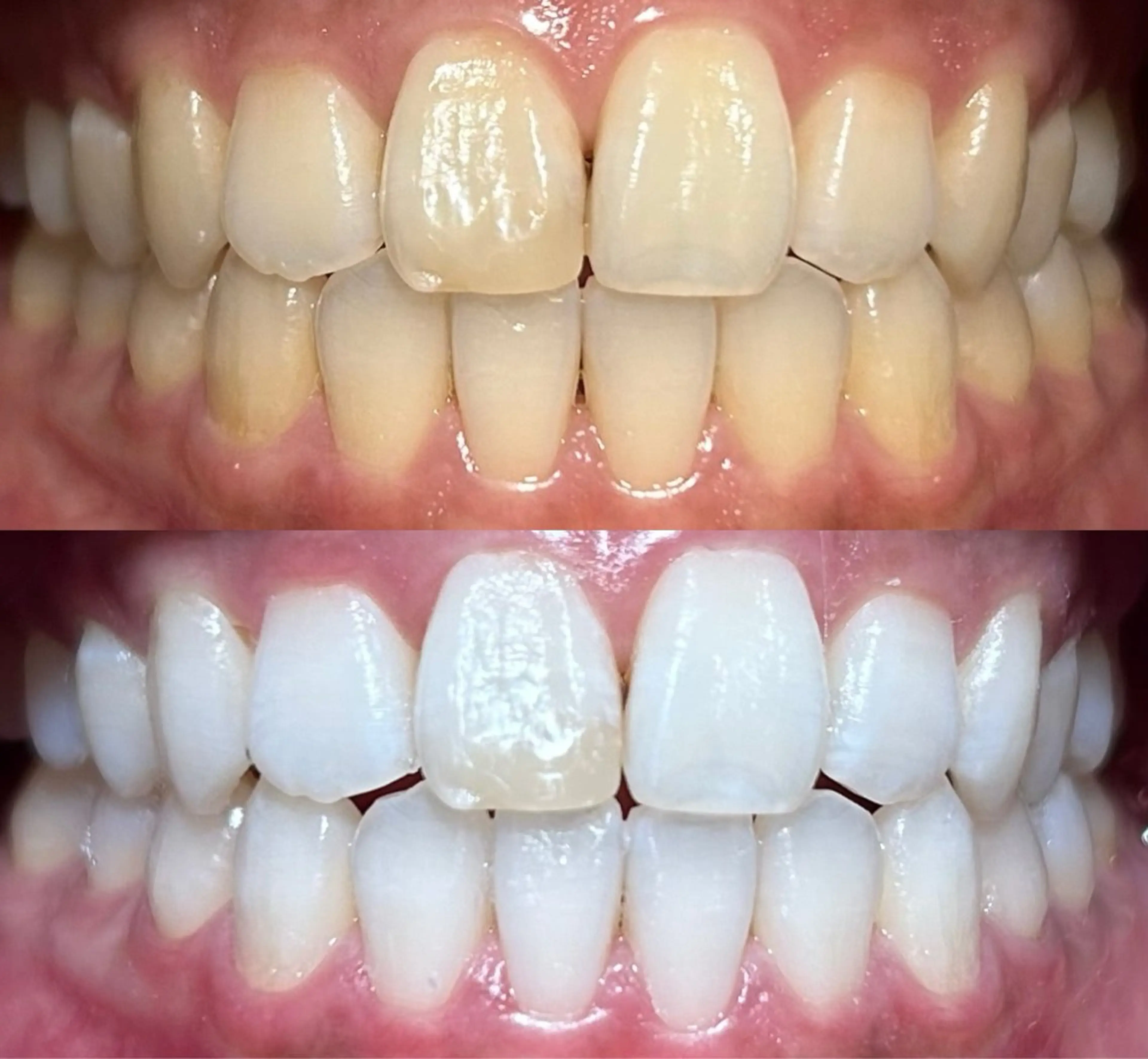 io teeth careのその他イメージ