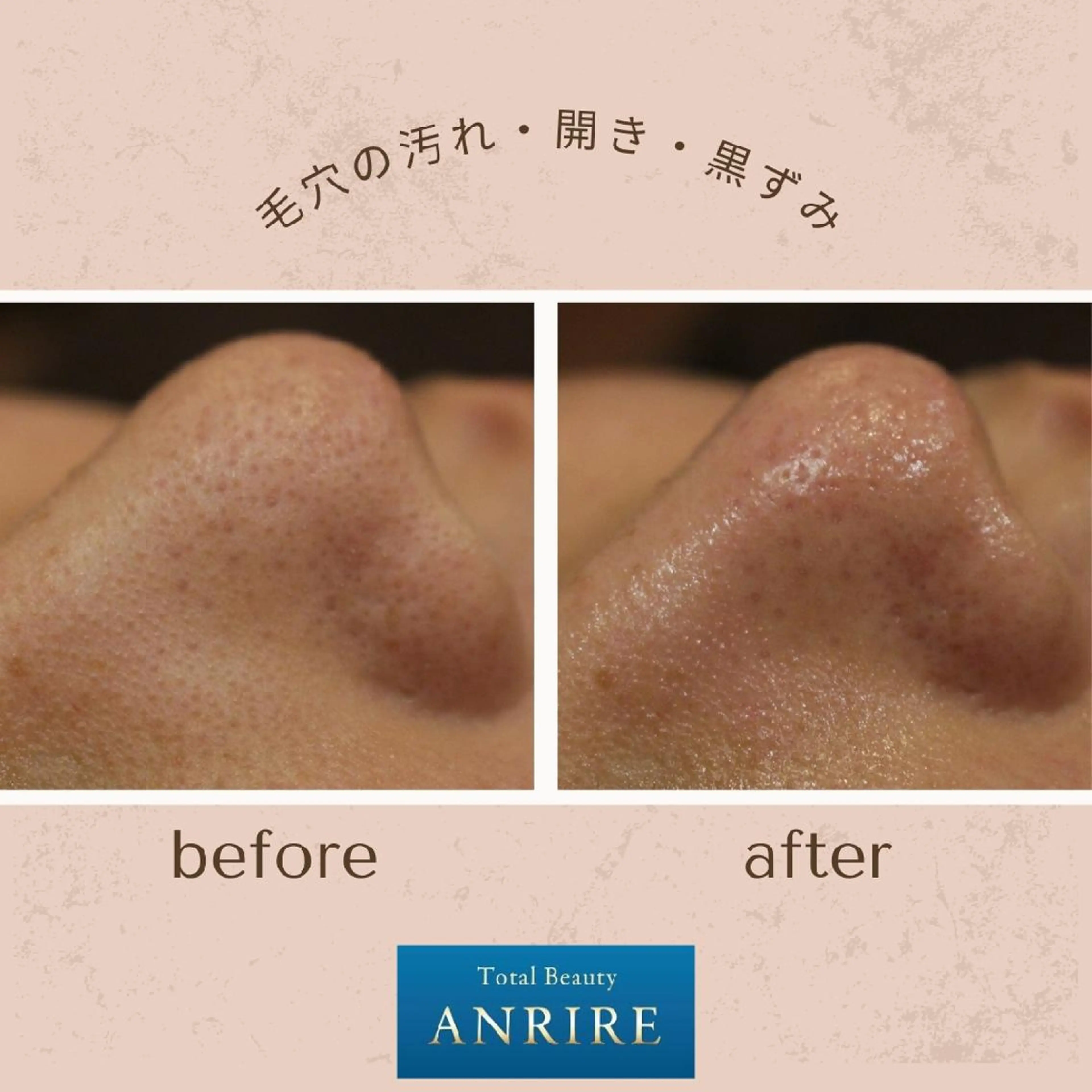 ANRIRE (アンリール)のエステ・リラクイメージ