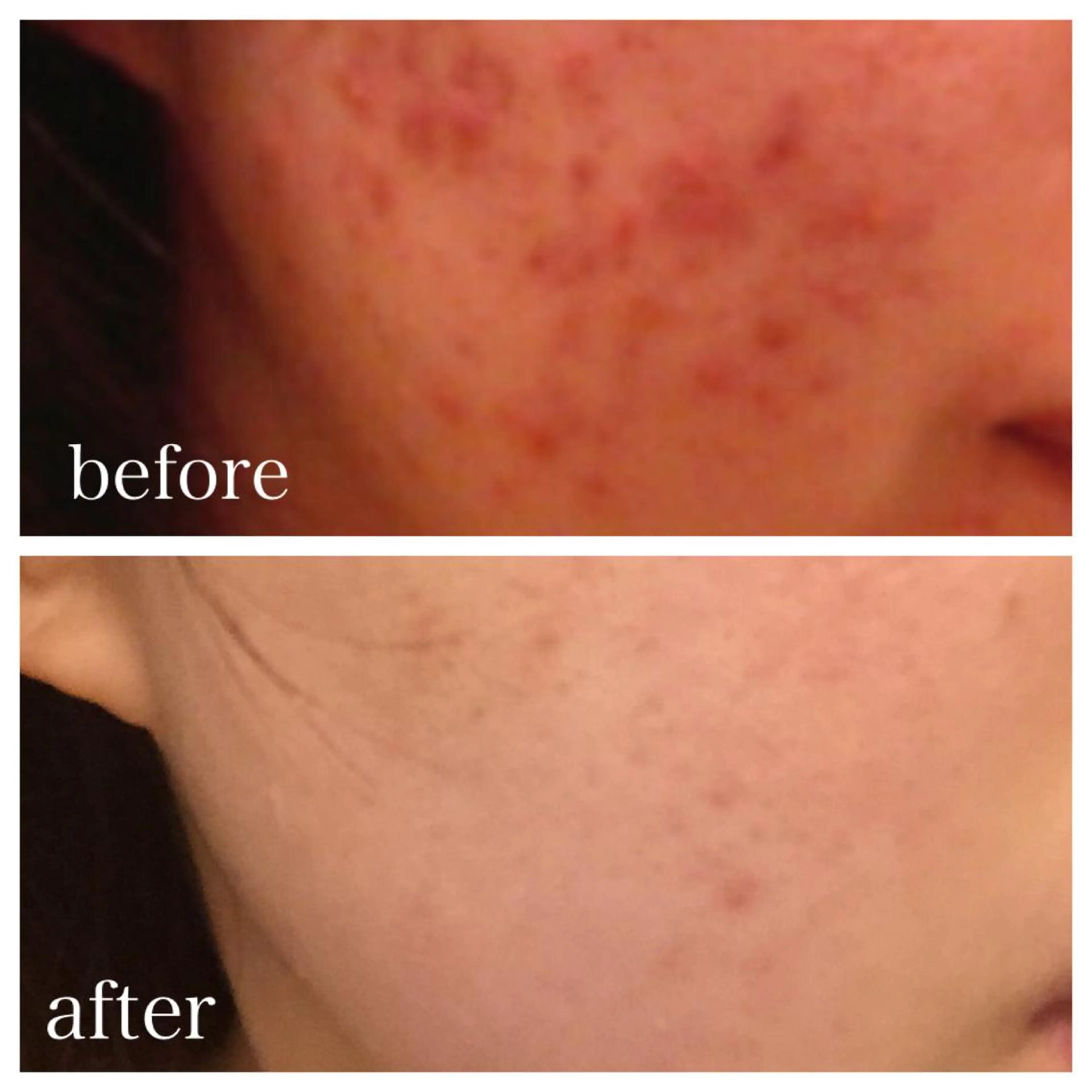 ショート マツエク・マツパ ニキビ跡専門サロン Ainaのエステ・リラクイメージ