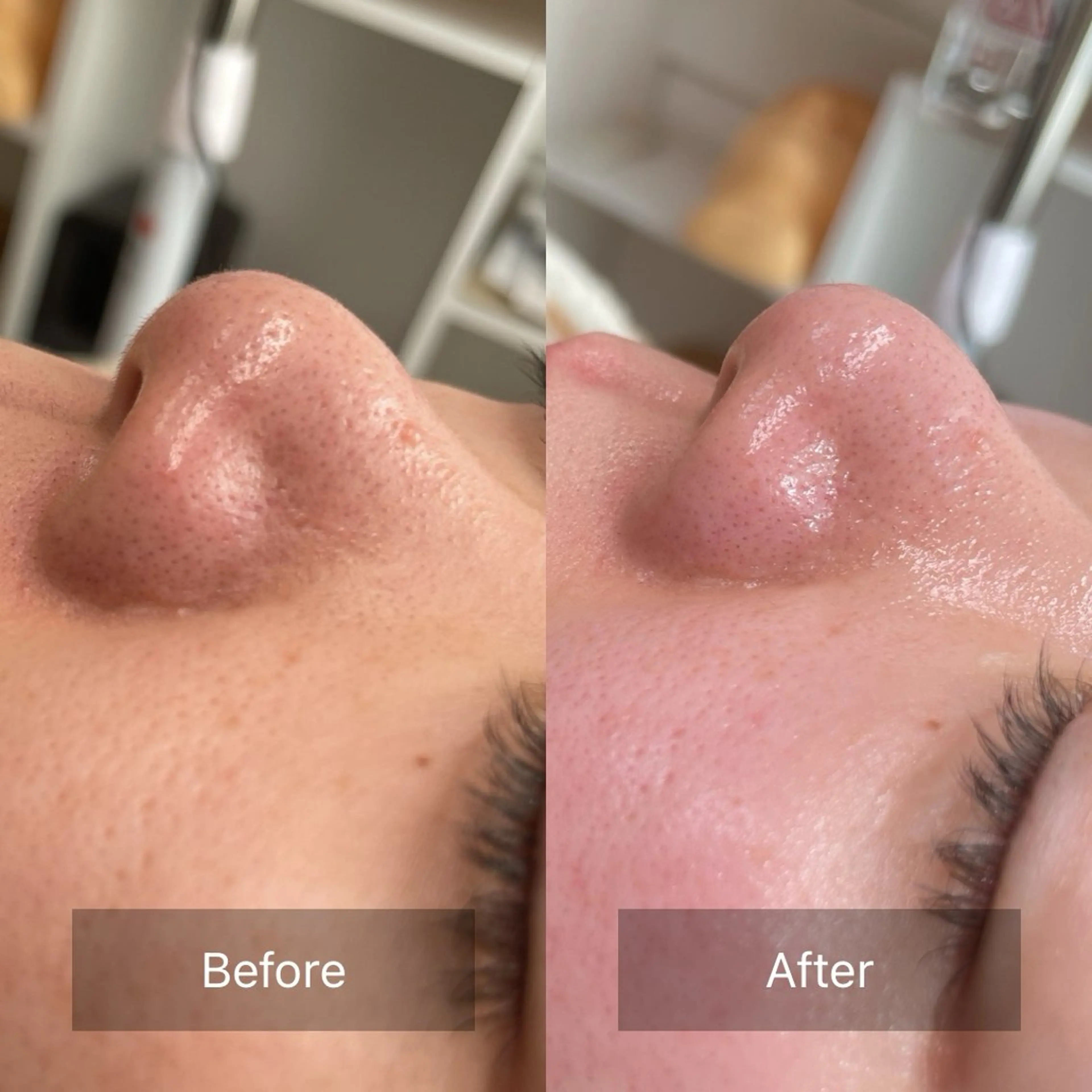 脱毛 ビューティーサロン Lino🫧mayuのエステ・リラクイメージ