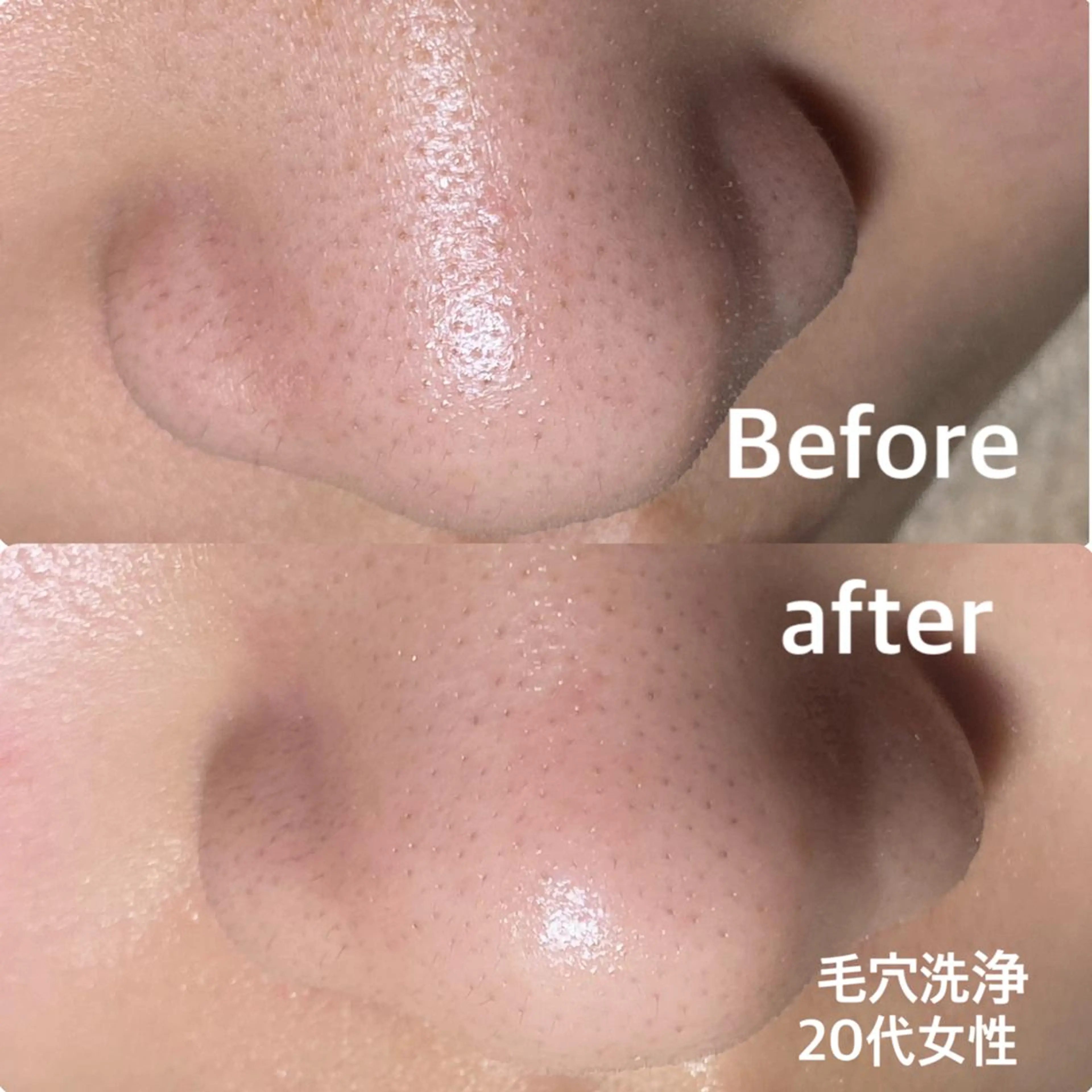 村松/ 小顔,ボディケアのエステ・リラクイメージ