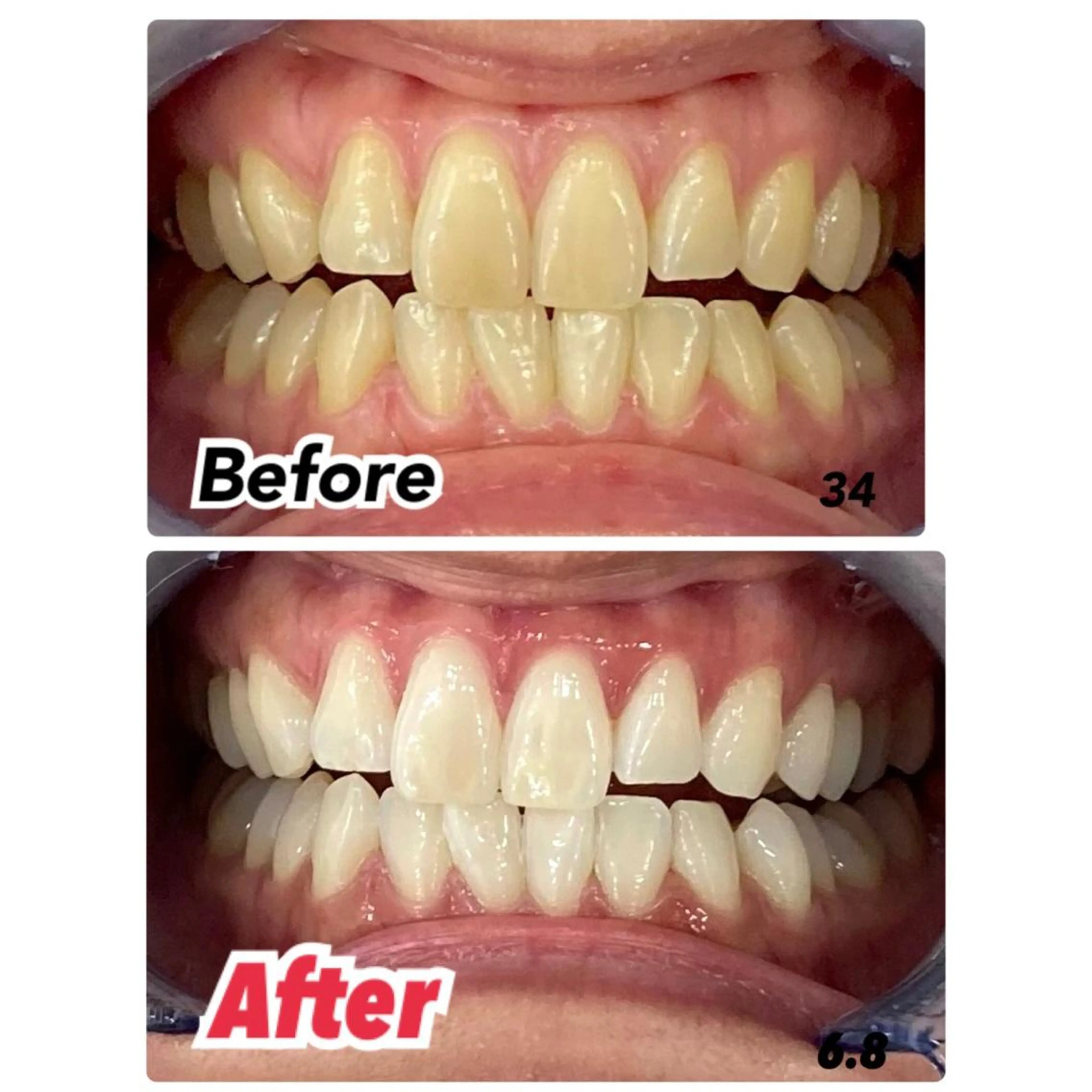 ミディアム メンズ マツエク・マツパ アイブロウ 【歯科提携】柏ホワイ トニングスタイルのその他イメージ