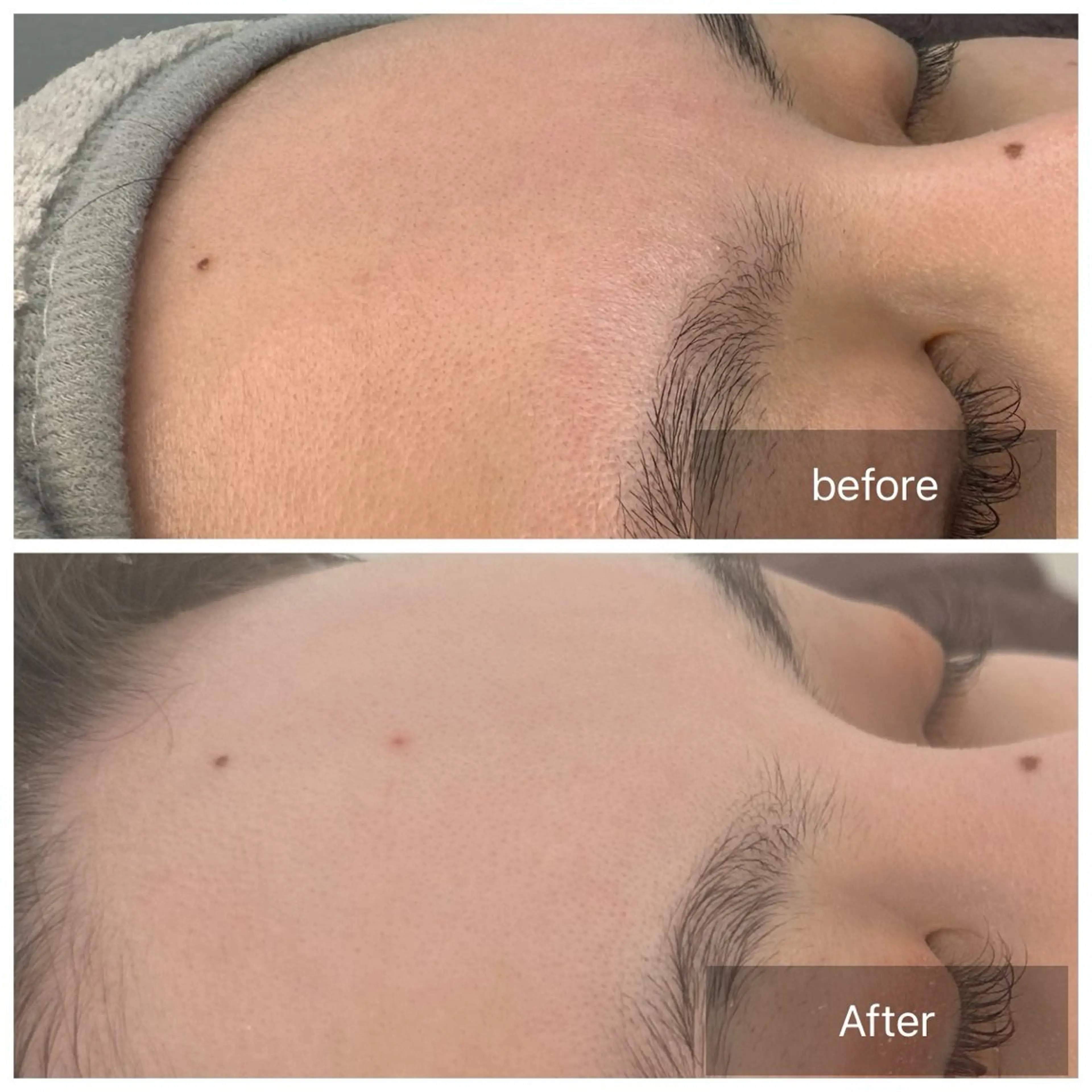 エステ トータルしみケア専門 NICA(ニカ)の眉毛・アイブロウイメージ