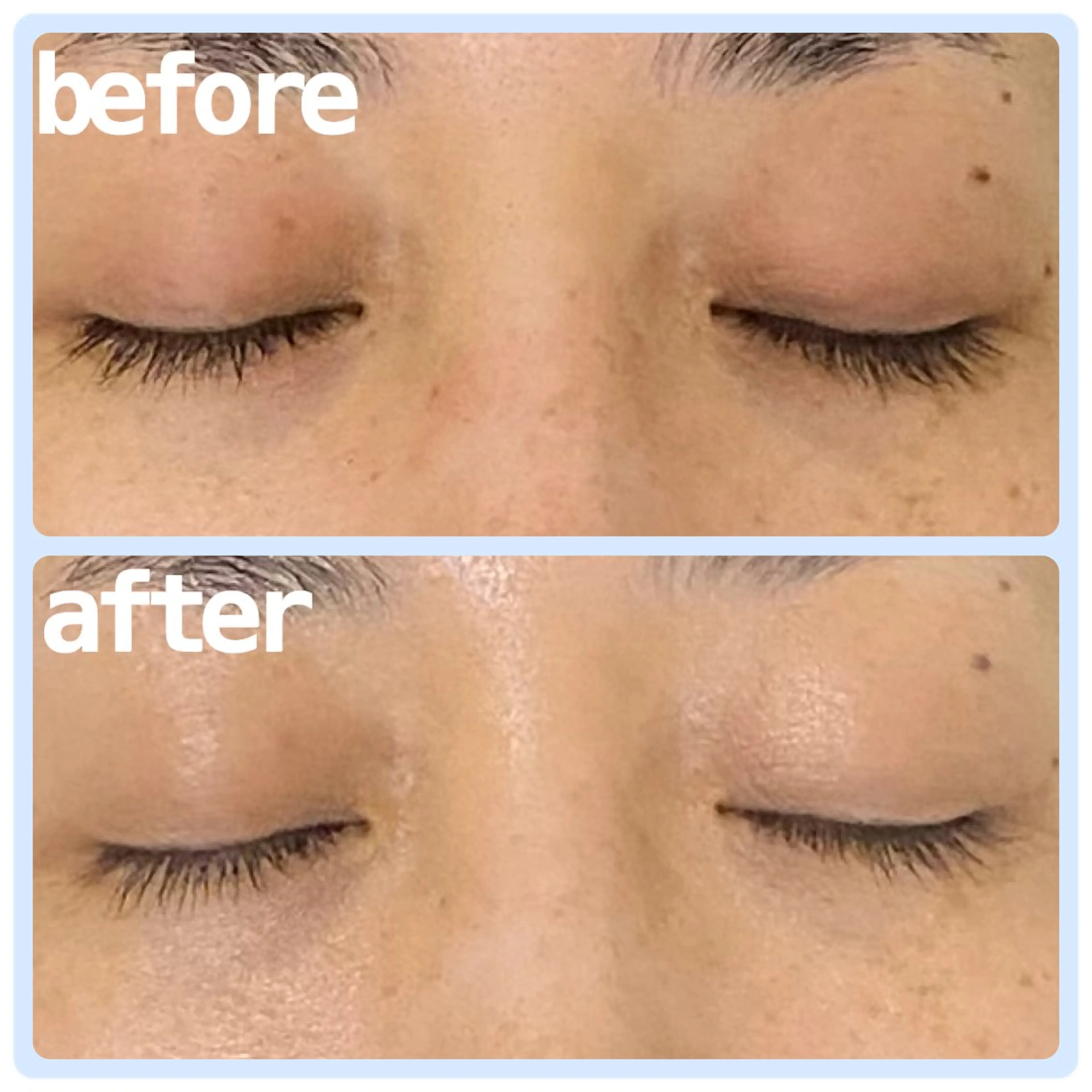 aimer beautyのエステ・リラクイメージ