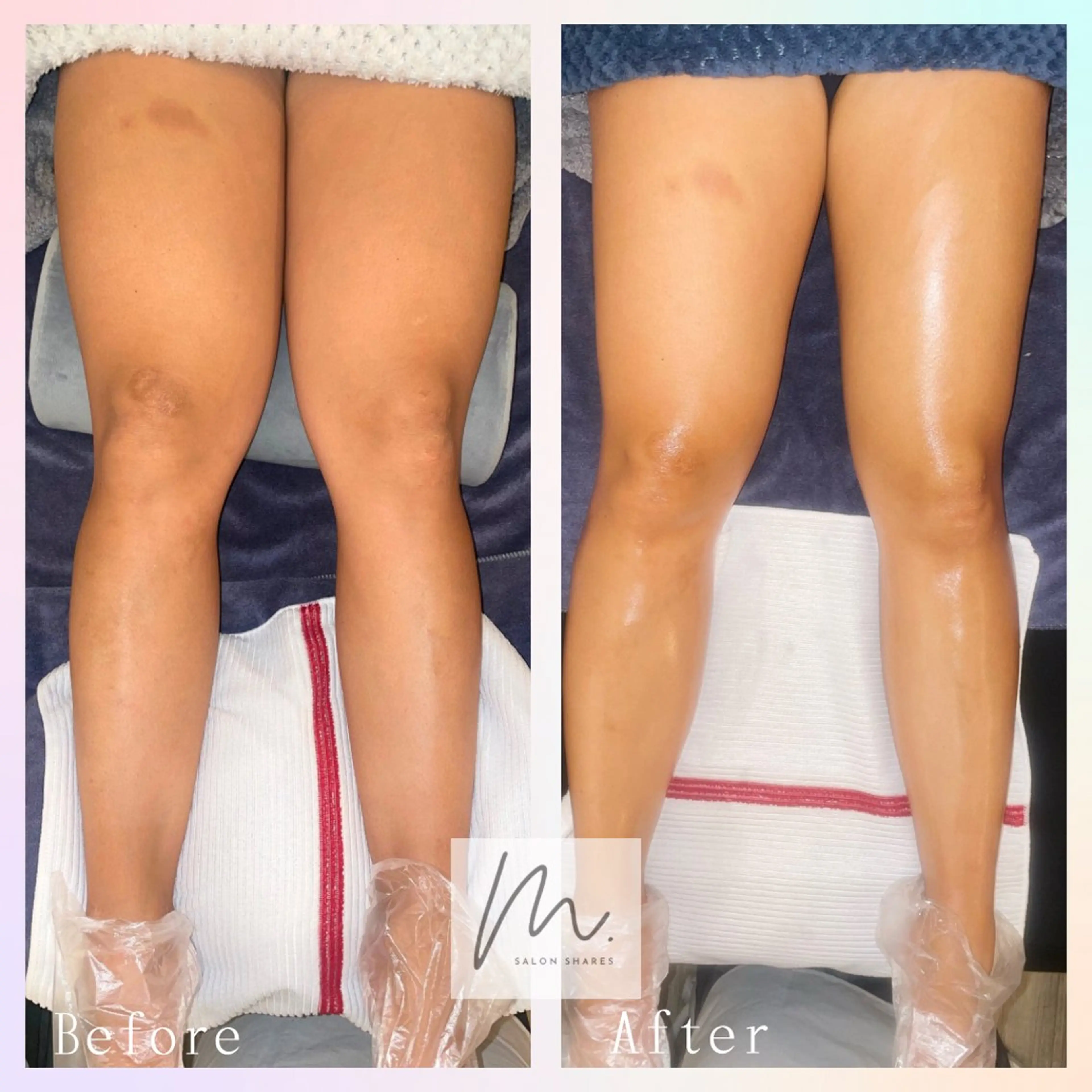 SHARES MADOKAのエステ・リラクイメージ