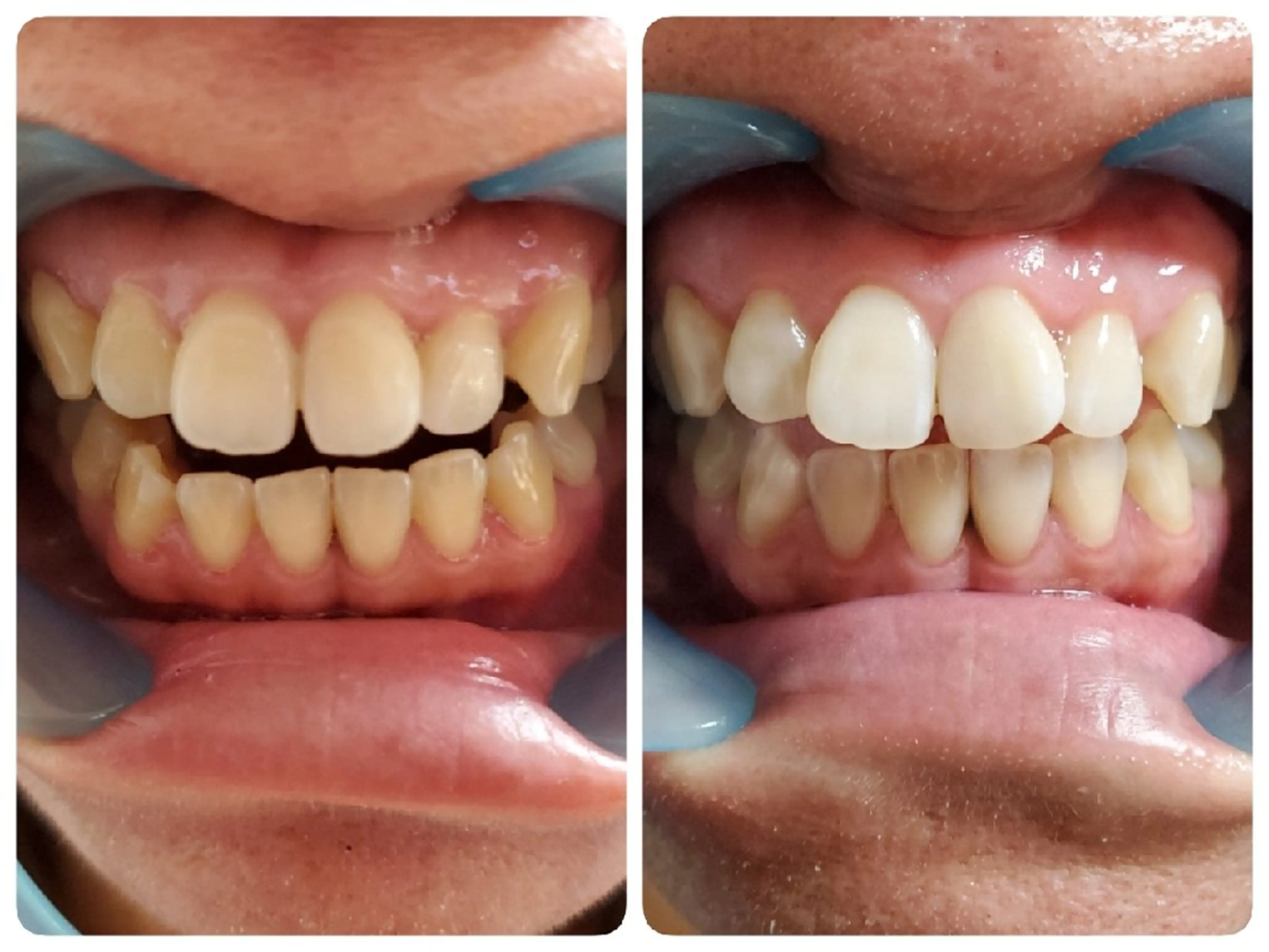 mind plus 【小顔　痩身　脱毛】のエステ・リラクイメージ