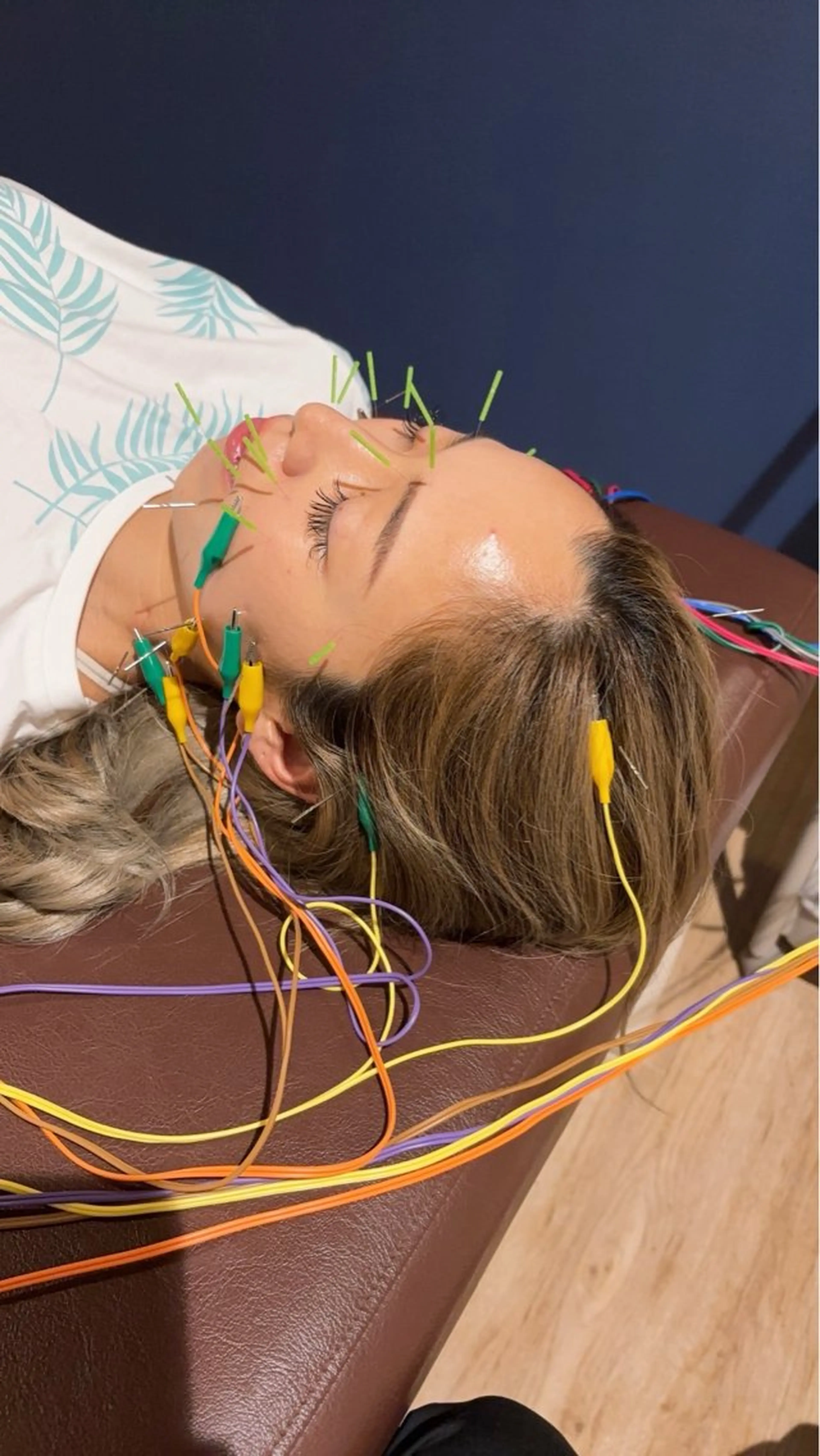 健康×美容鍼鍼灸院 あさば整骨院南流山店のエステ・リラクイメージ