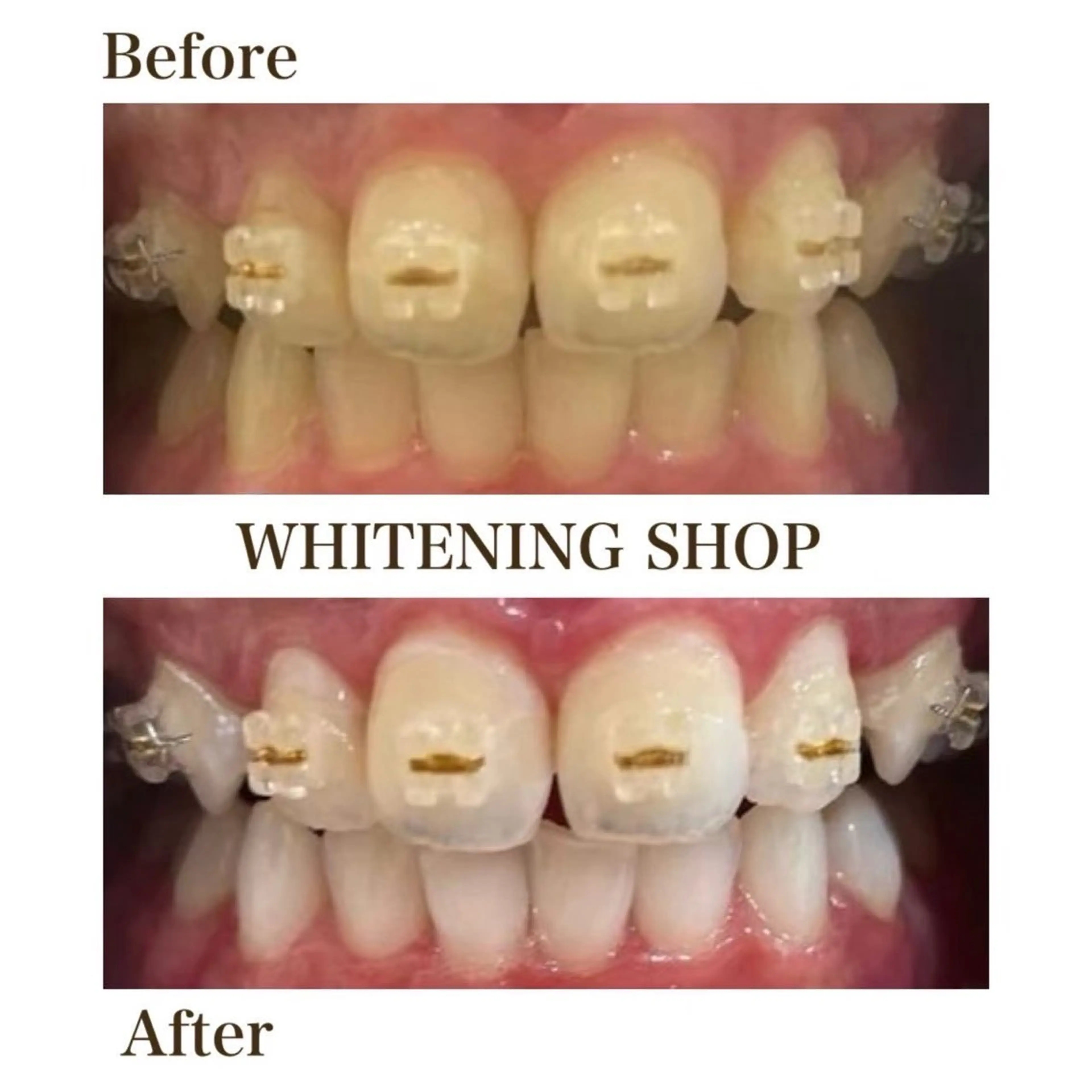 その他 ホワイトニング ショップ津店のその他イメージ