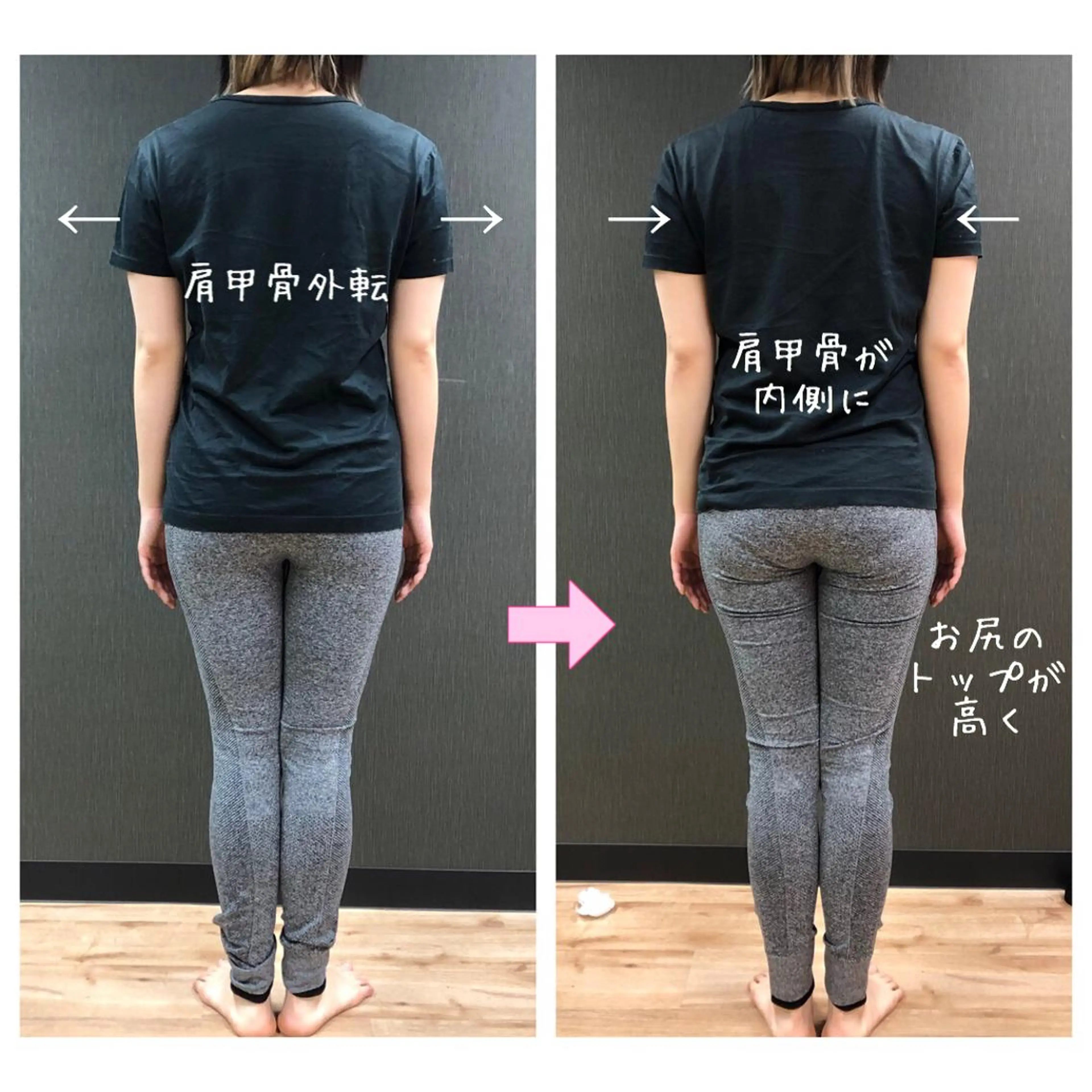 小顔モニター 募集のエステ・リラクイメージ