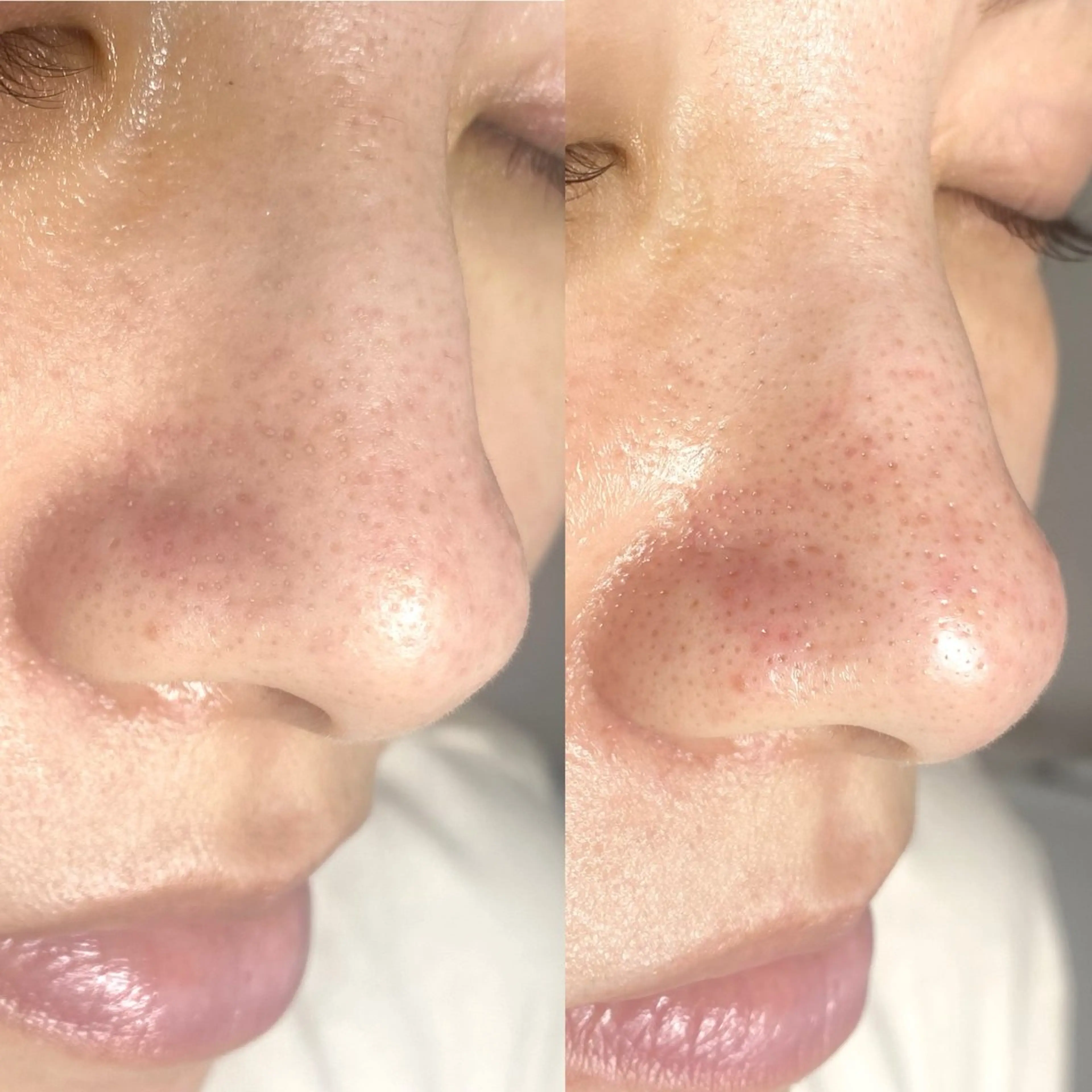 mone (モーネ)のエステ・リラクイメージ