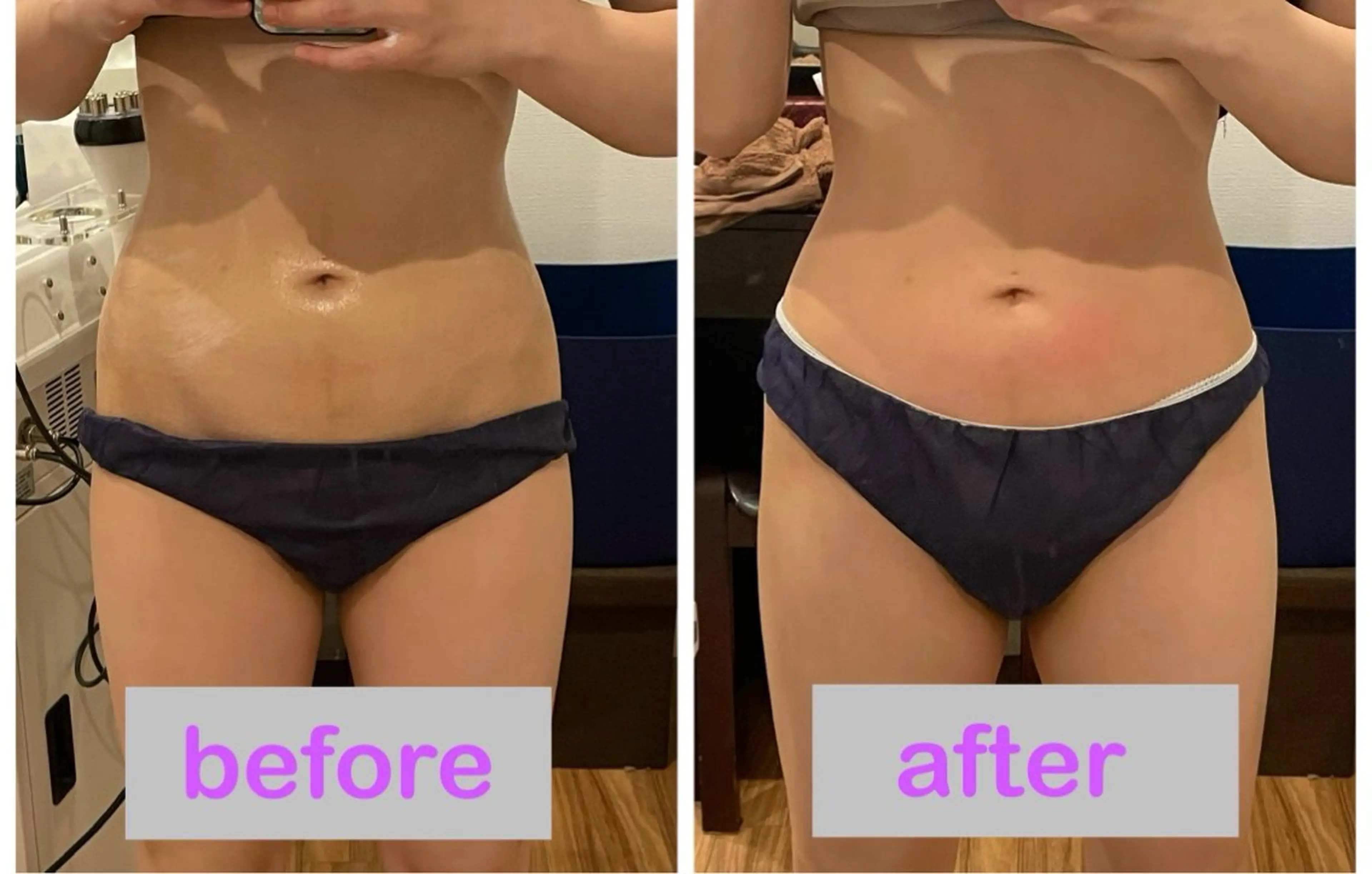 酵そや 石澤のエステ・リラクイメージ