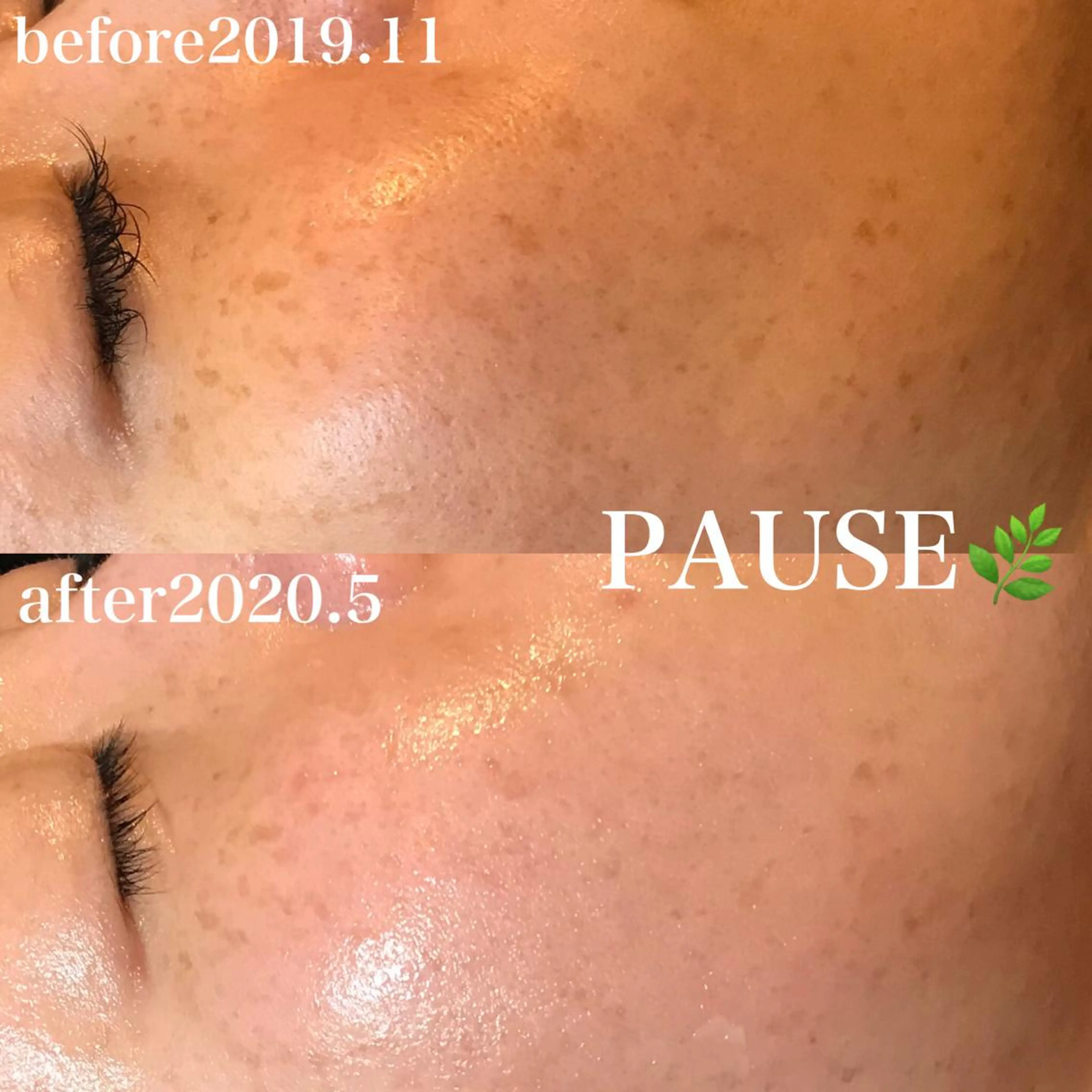 エステ 浜野 恵美のエステ・リラクイメージ