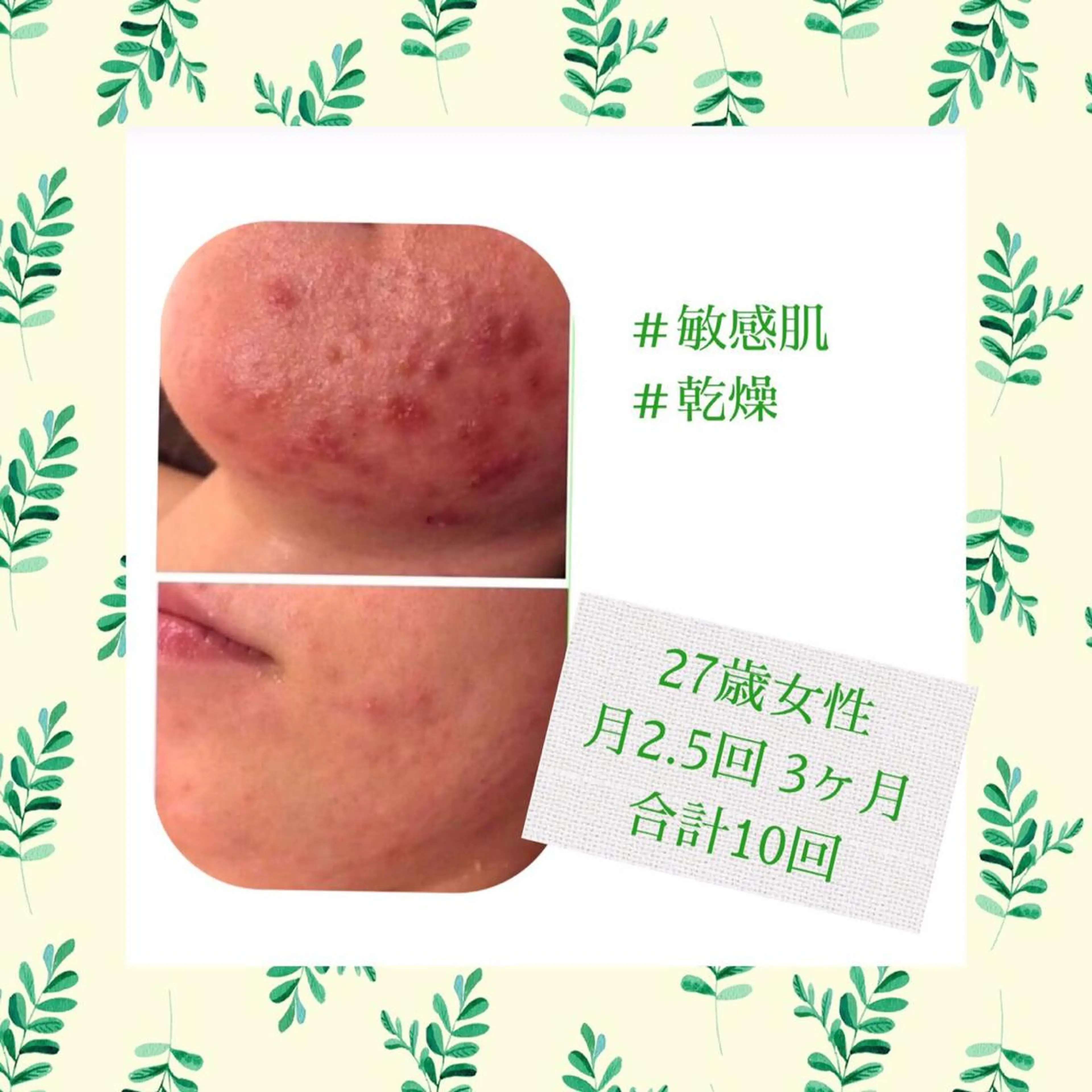 ミディアム カラー パーマ ヘアアレンジ メンズ キッズ ネイル マツエク・マツパ エステ リラク ニキビ・肌質改善専門 ♡人生が変わるサロンのエステ・リラクイメージ