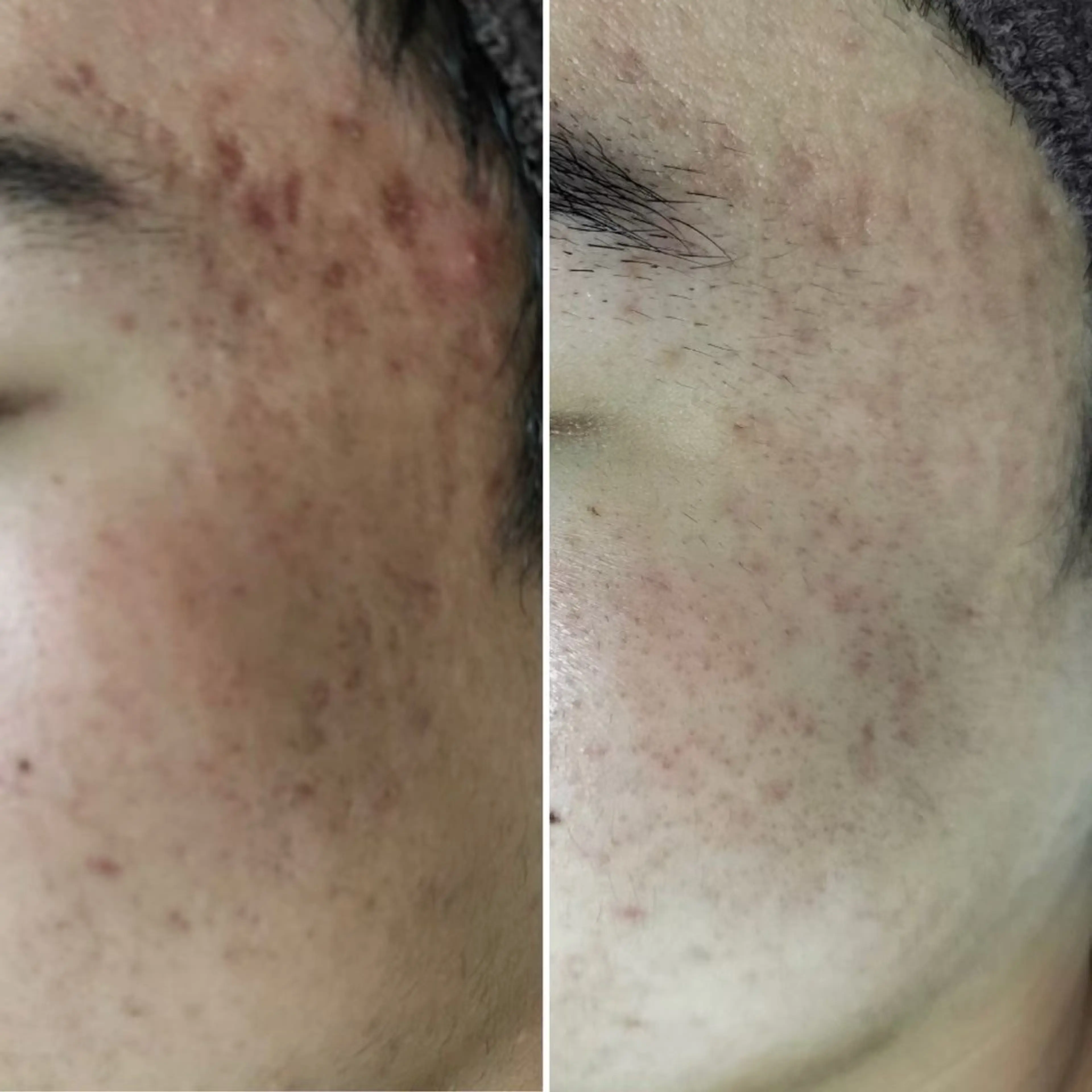 エステ 毛穴改善サロン d'Alba大阪住吉のエステ・リラクイメージ