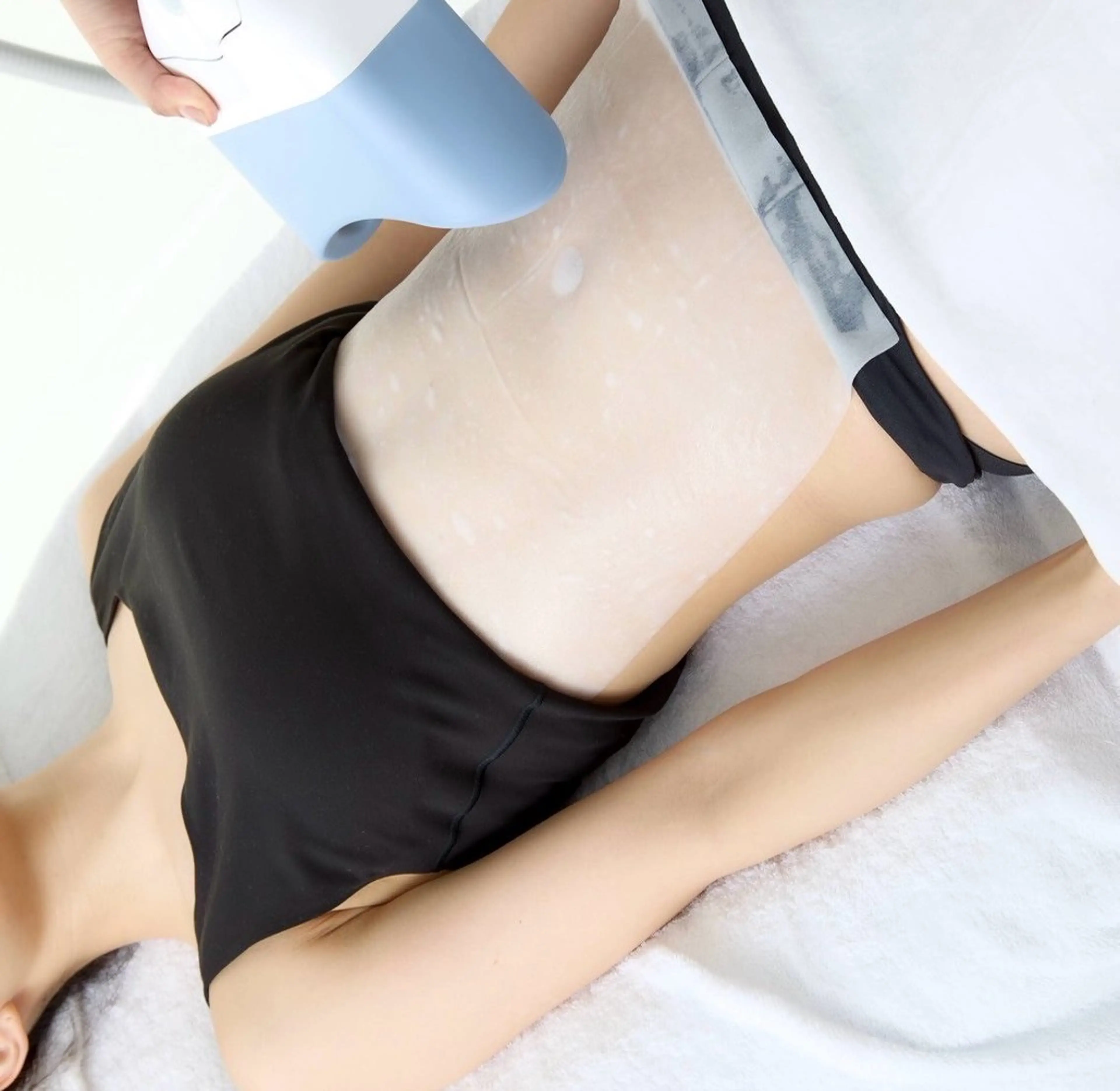 【冷却痩身】浮き輪肉撃退／痩身コース（お腹・腰・背面）の写真