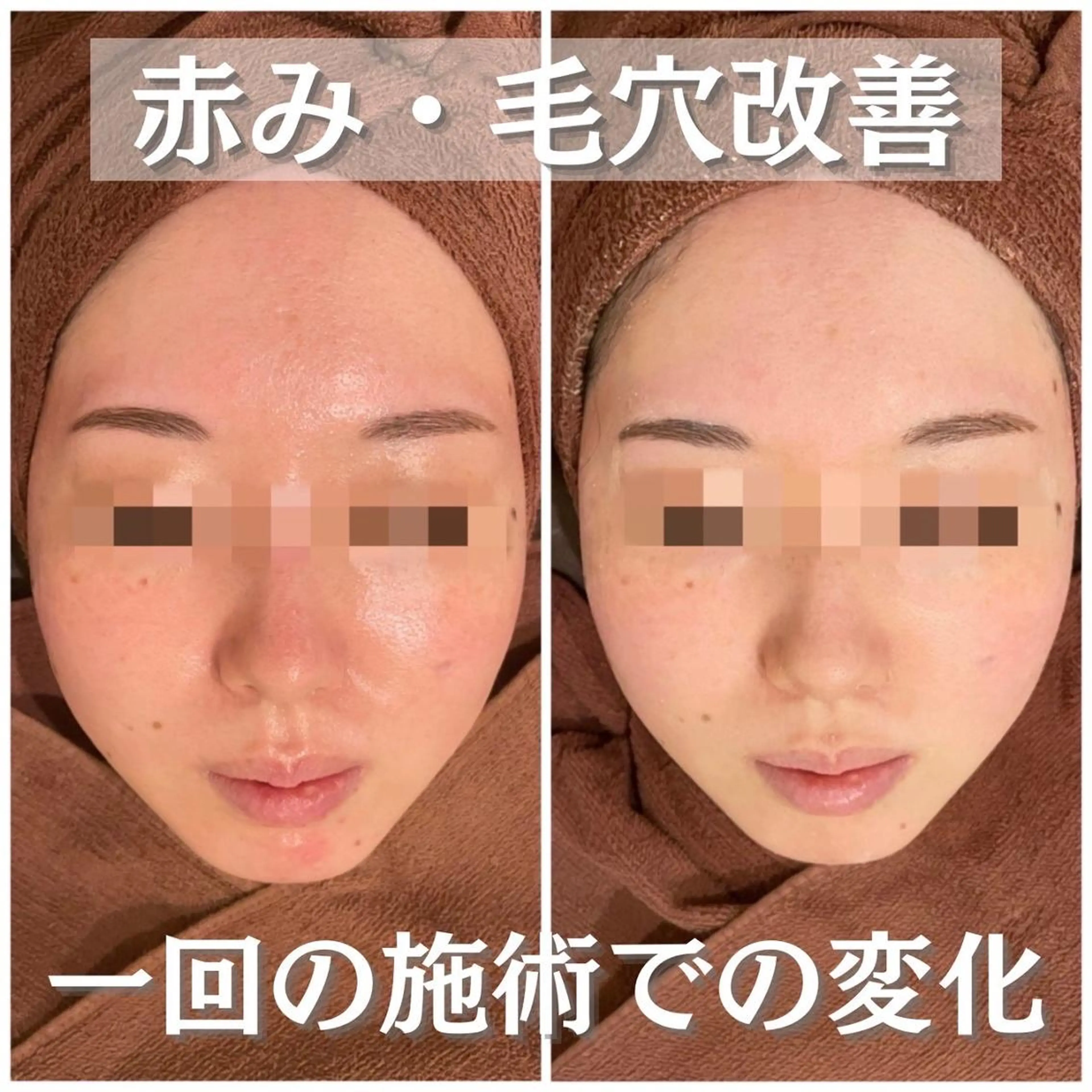 ニキビ経験者が施術 する専門サロン🌻のエステ・リラクイメージ