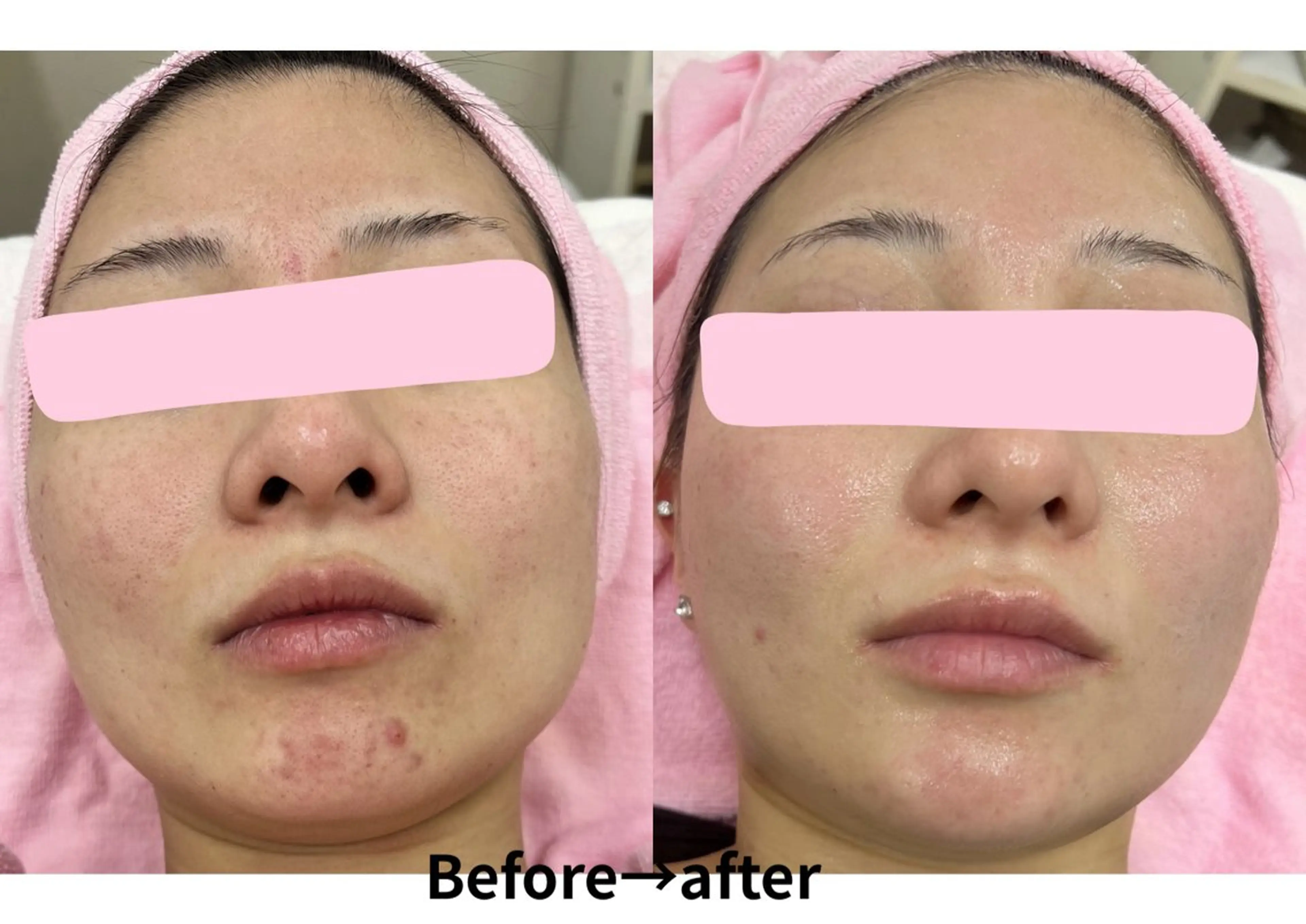 Rassurer 山本のその他イメージ