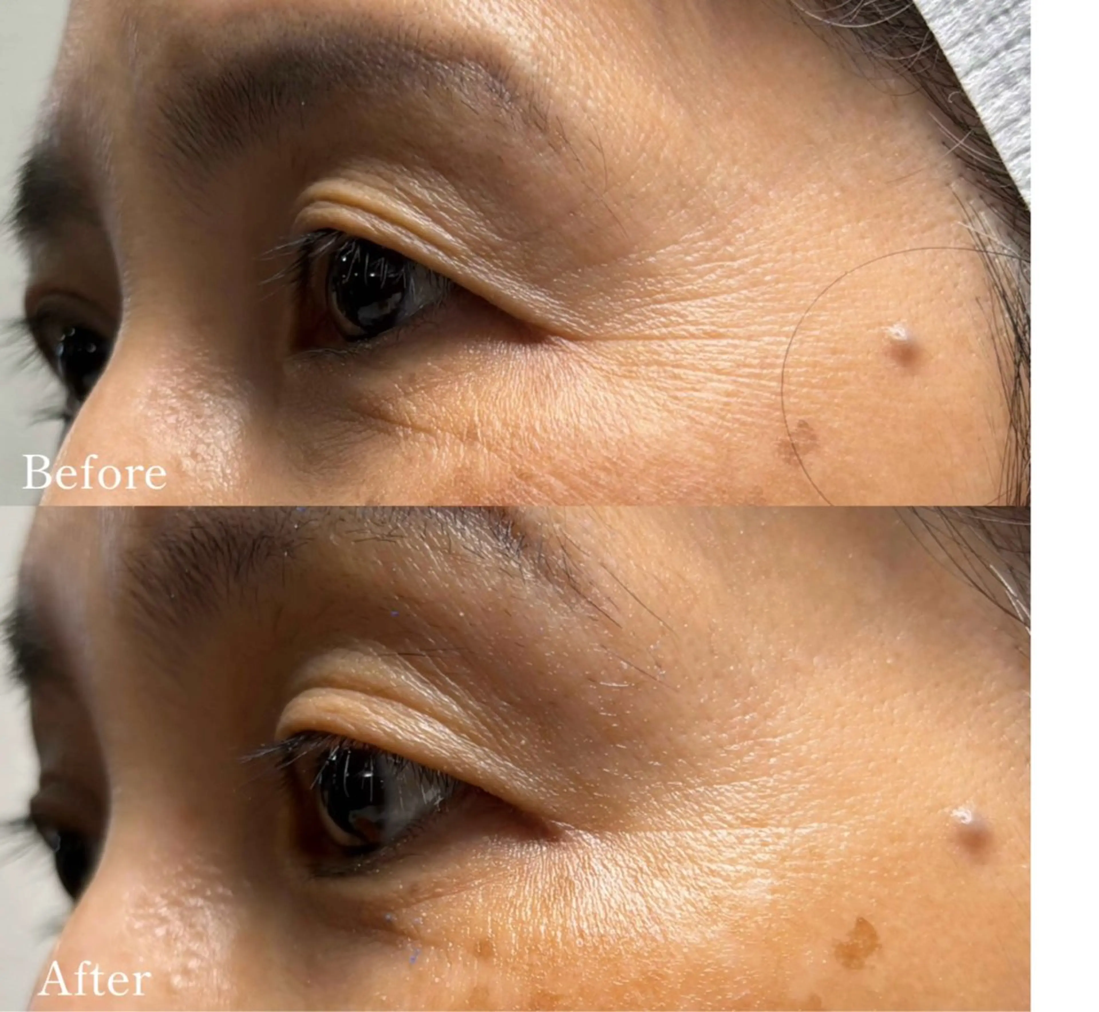 脱毛専門 ページ/Bloomのエステ・リラクイメージ