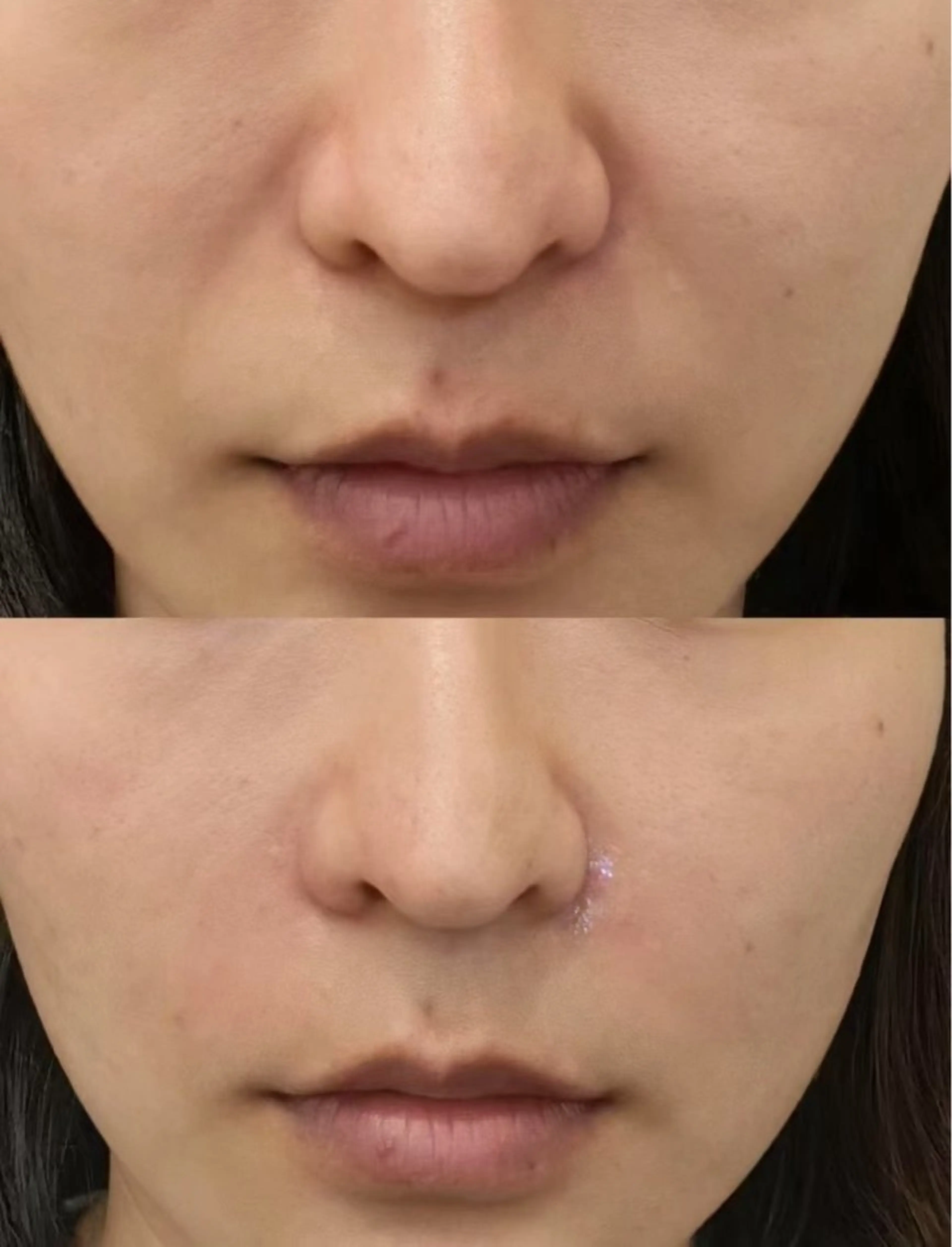 ネイル aliaハーブ水光店 エステティシャン募集のエステ・リラクイメージ