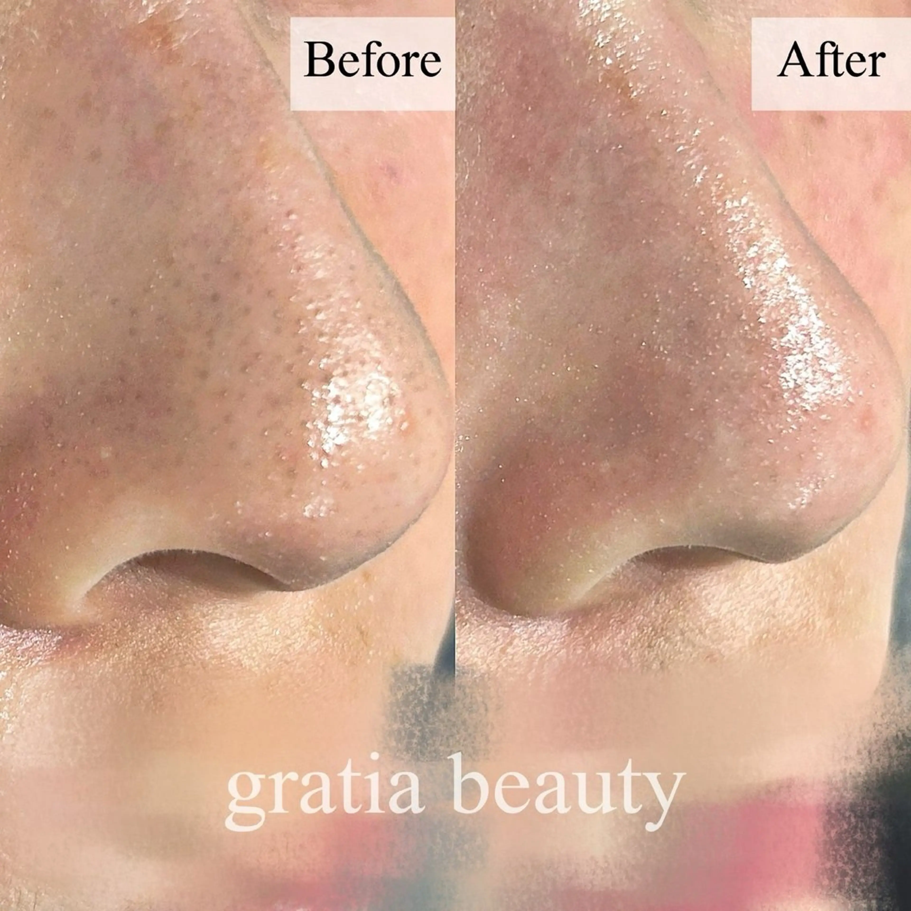 エステ gratia salonのエステ・リラクイメージ