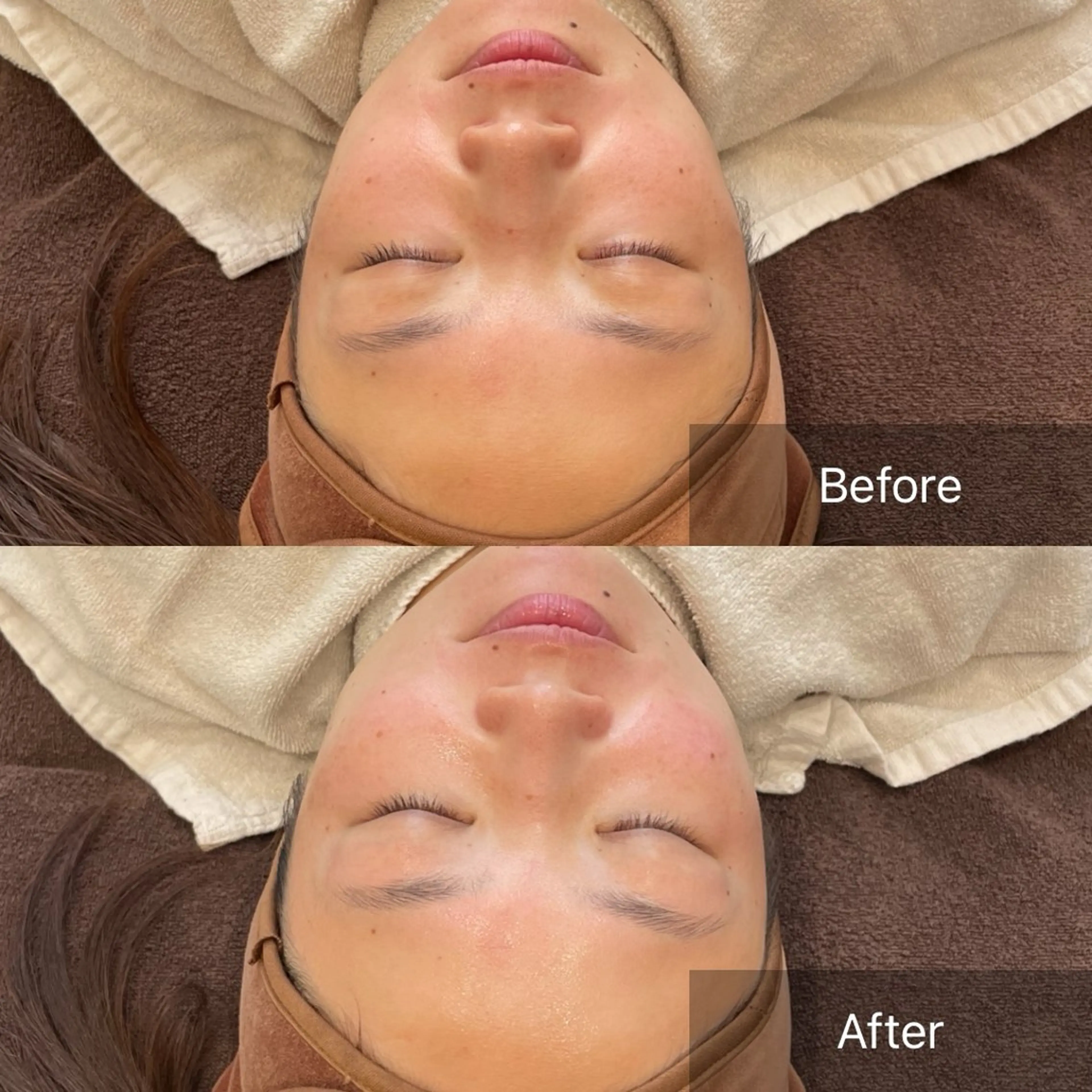 【毛穴の黒ずみ・角栓ケア】お肌がキレイになるフェイスワックス全顔メニュー⭐︎低刺激のワックスでメイクノリUP！！の写真