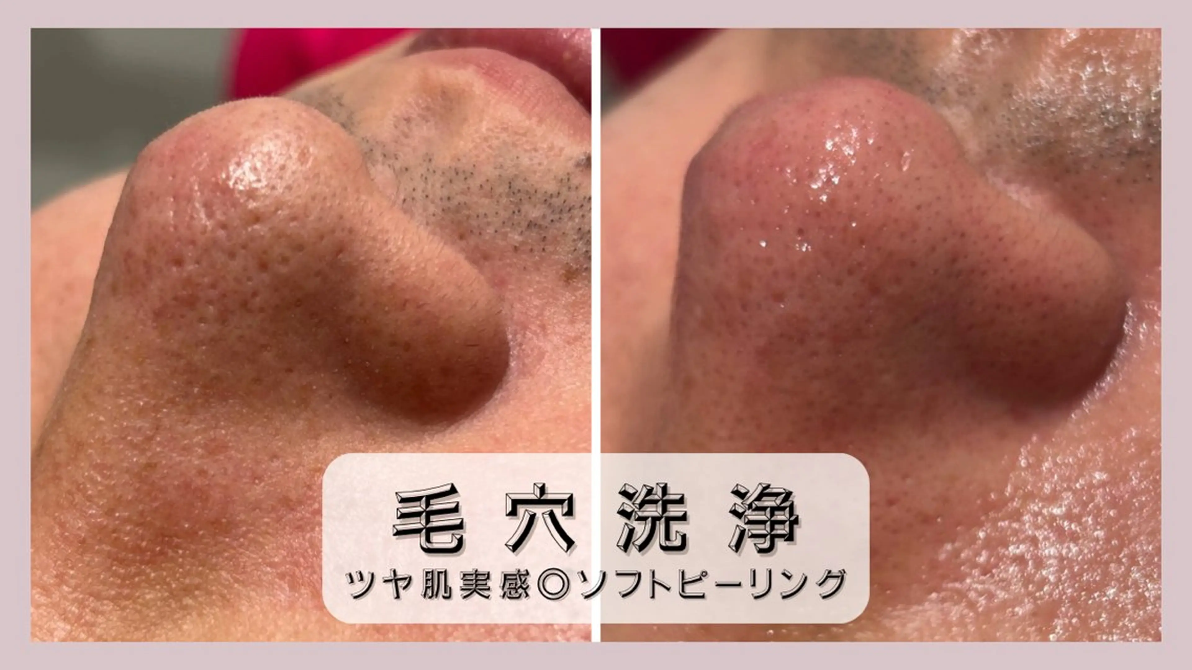 エステ Beauty  salon Lien所属・大村市Lien＊ 中川内翔子のエステ・リラクイメージ