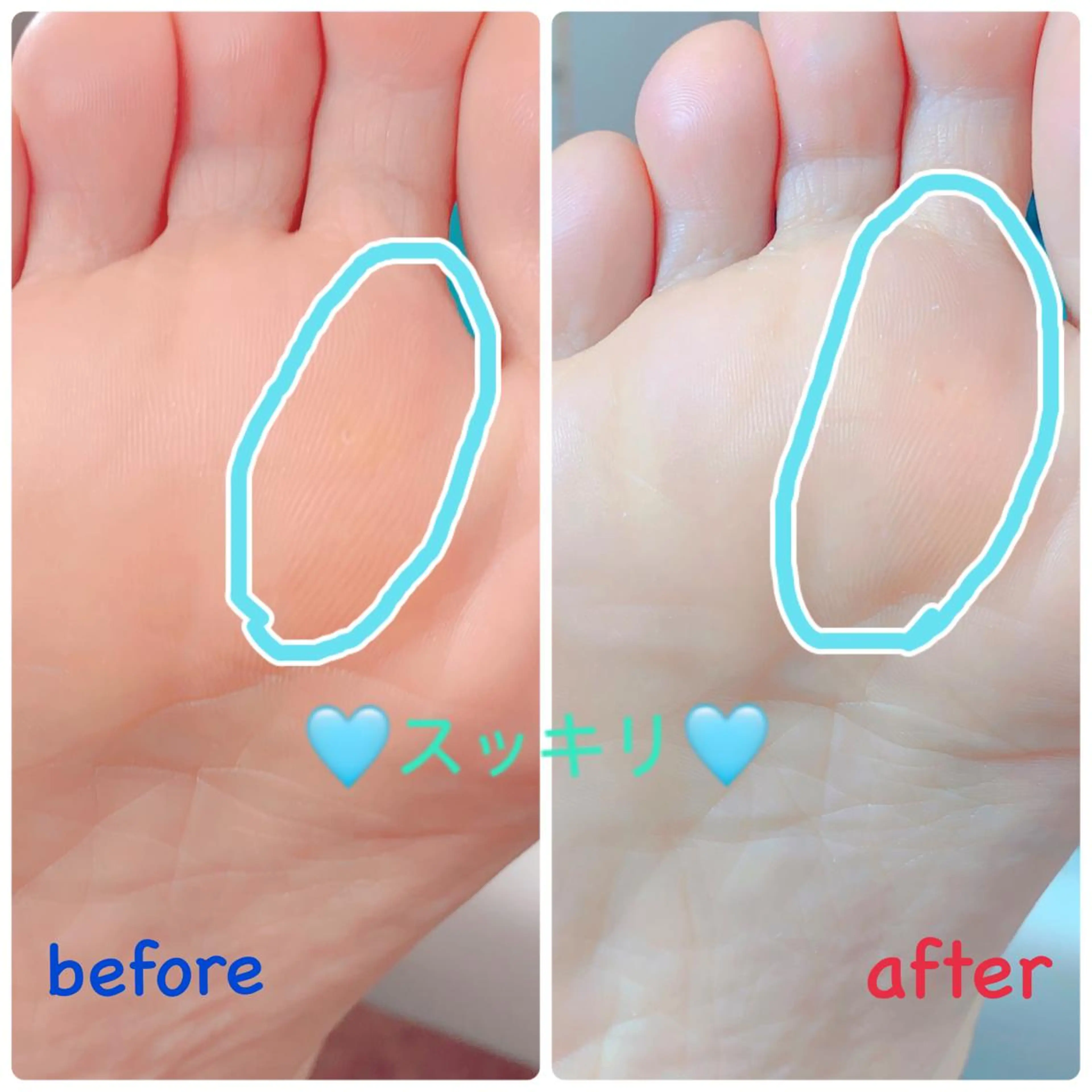 ネイル その他(ネイル) 柴崎 美幸のネイルデザイン