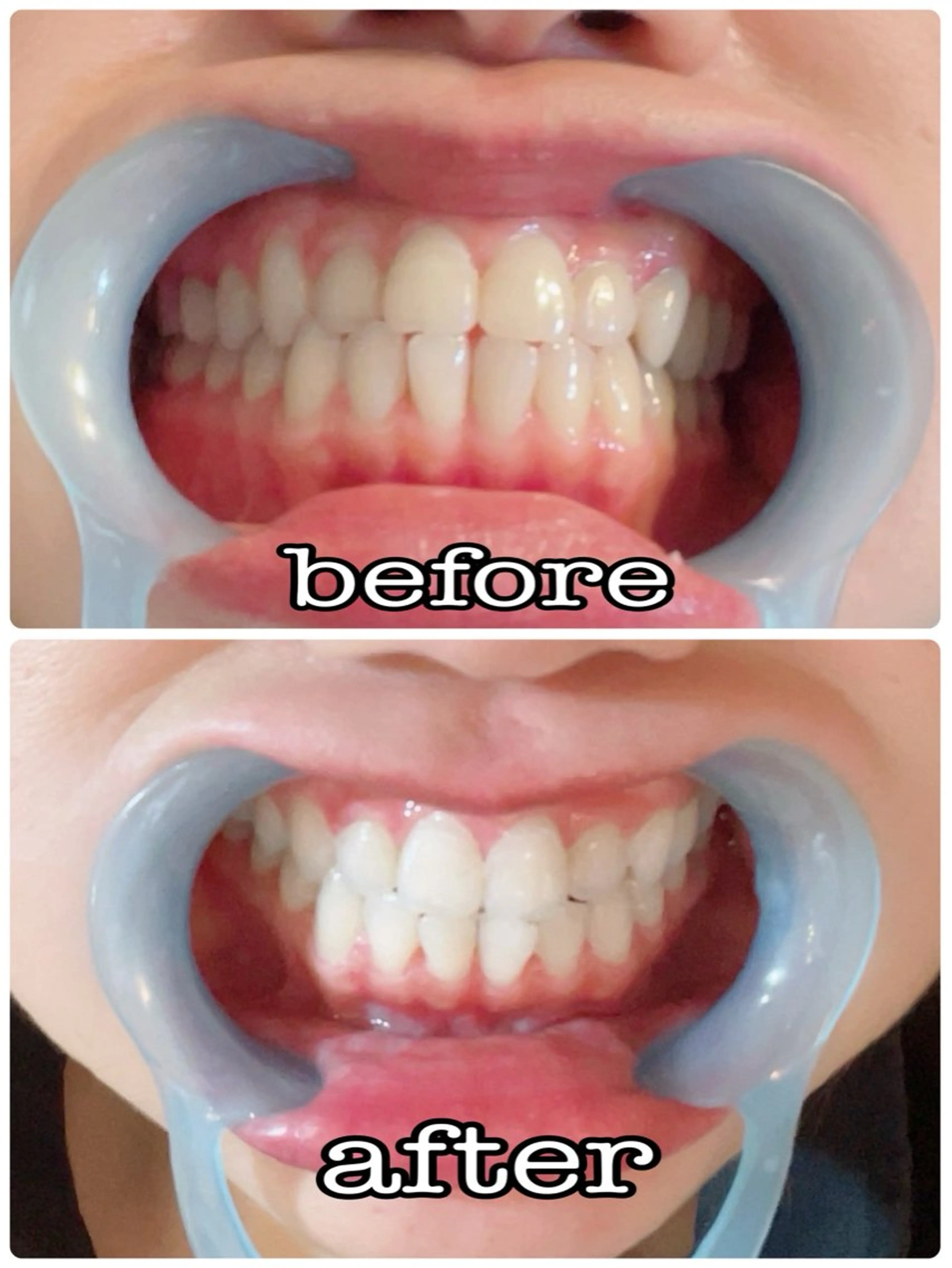 LOVELASH所属・恵比寿 LOVELASHのマツエク・マツパデザイン