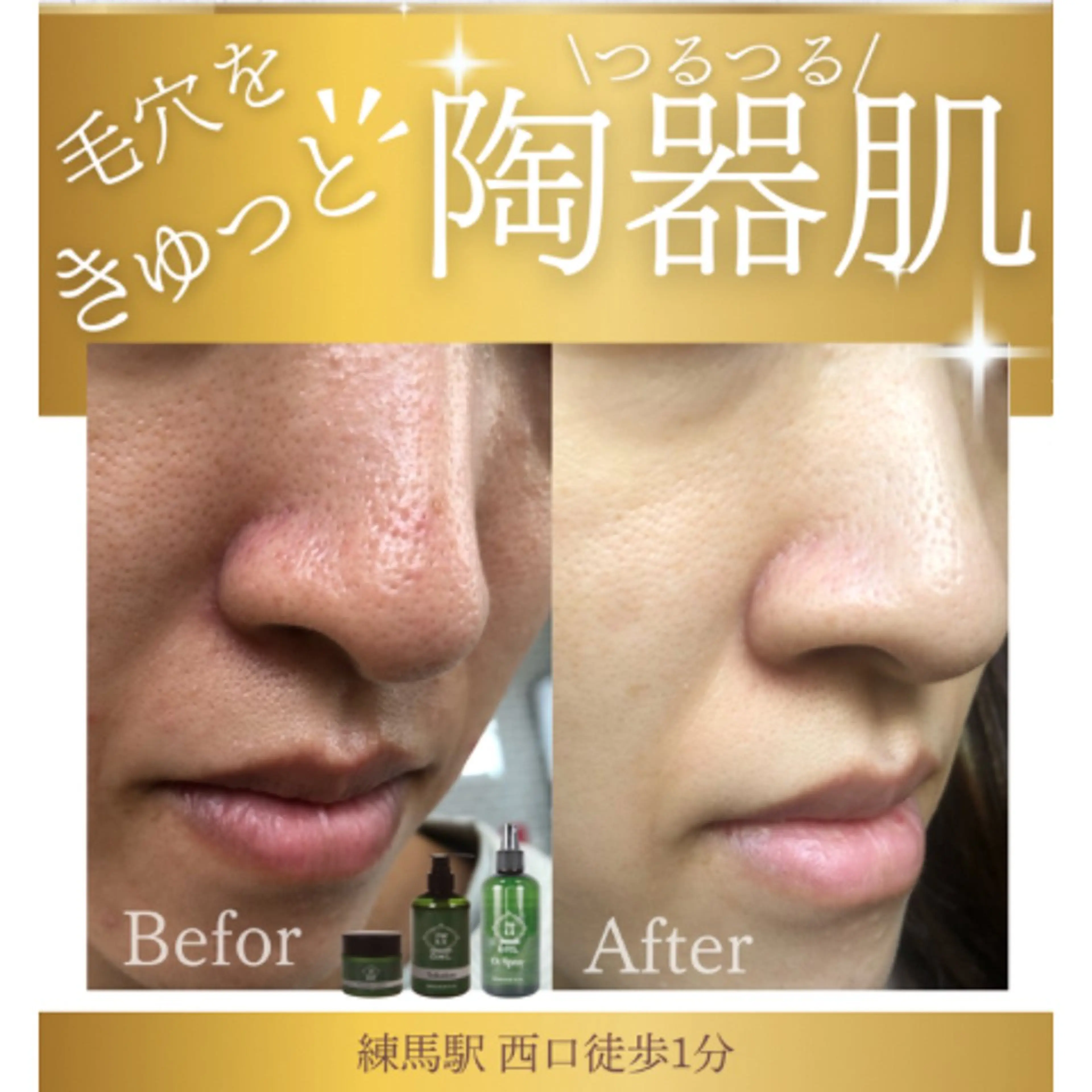 年齢肌/大人の肌管理 💎ぷるる練馬/山口のエステ・リラクイメージ