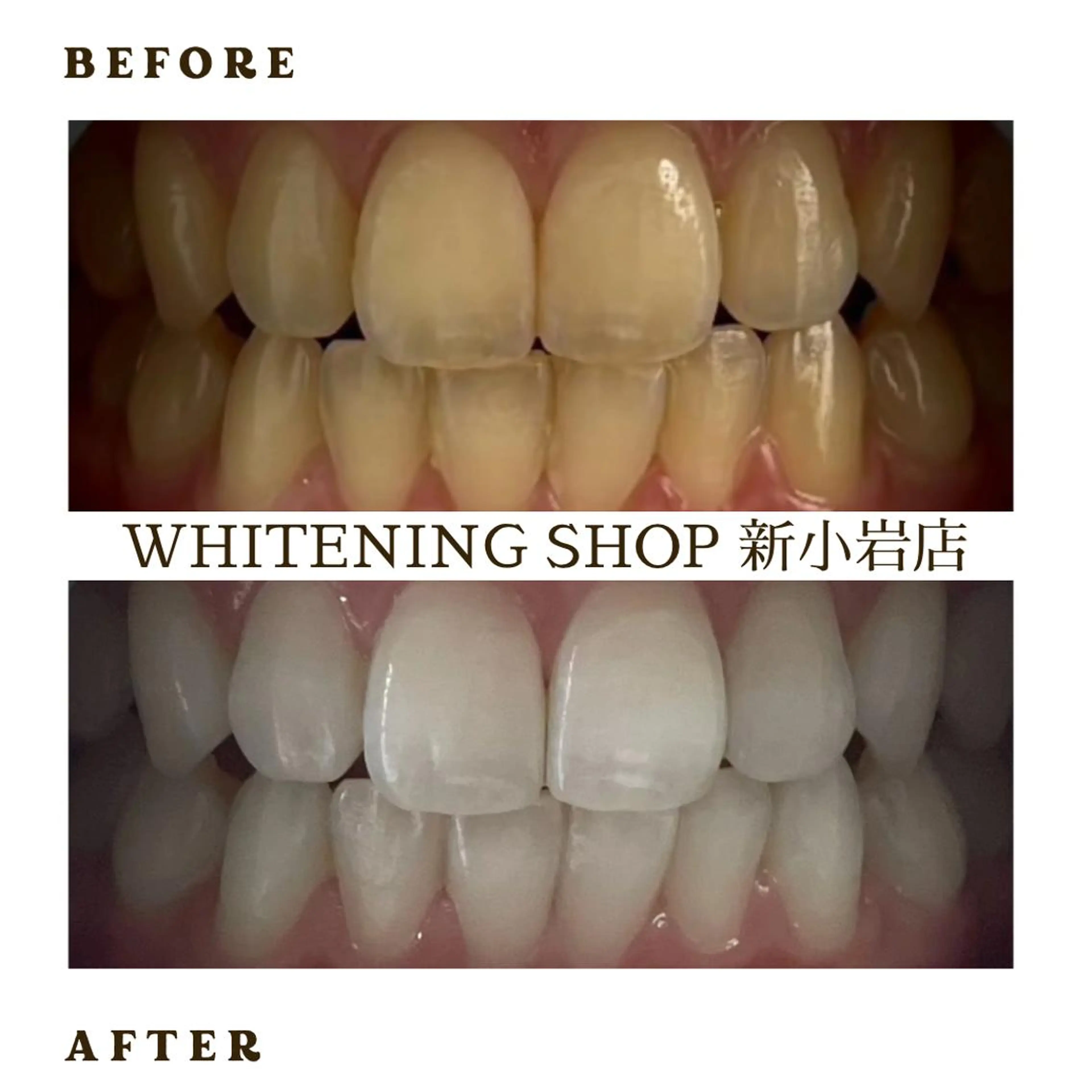 メンズ その他 ホワイトニング ショップ新小岩店のその他イメージ