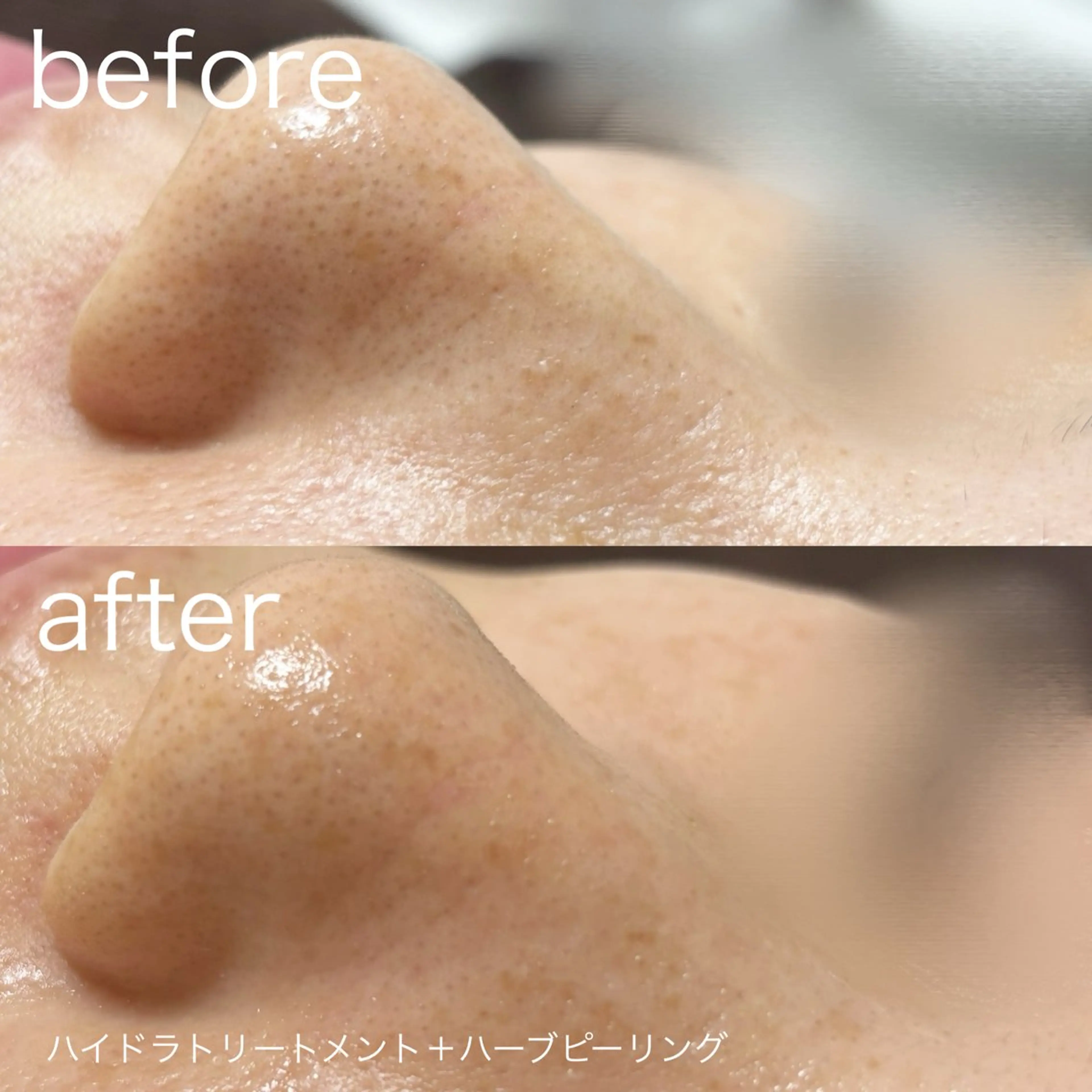 lulularico Yuのエステ・リラクイメージ