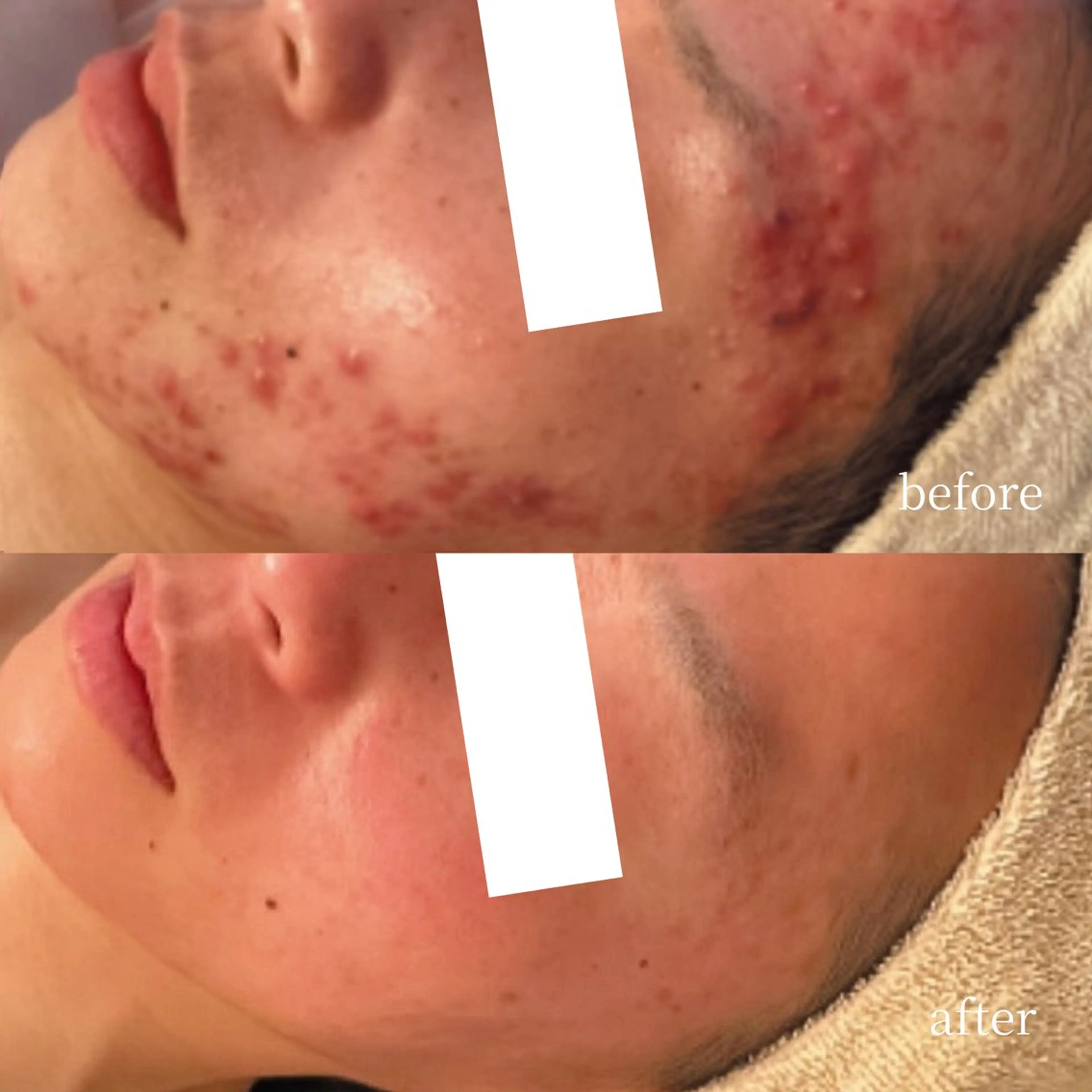 エステ 韓国肌管理・肌質改善 EARNEST心斎橋のエステ・リラクイメージ