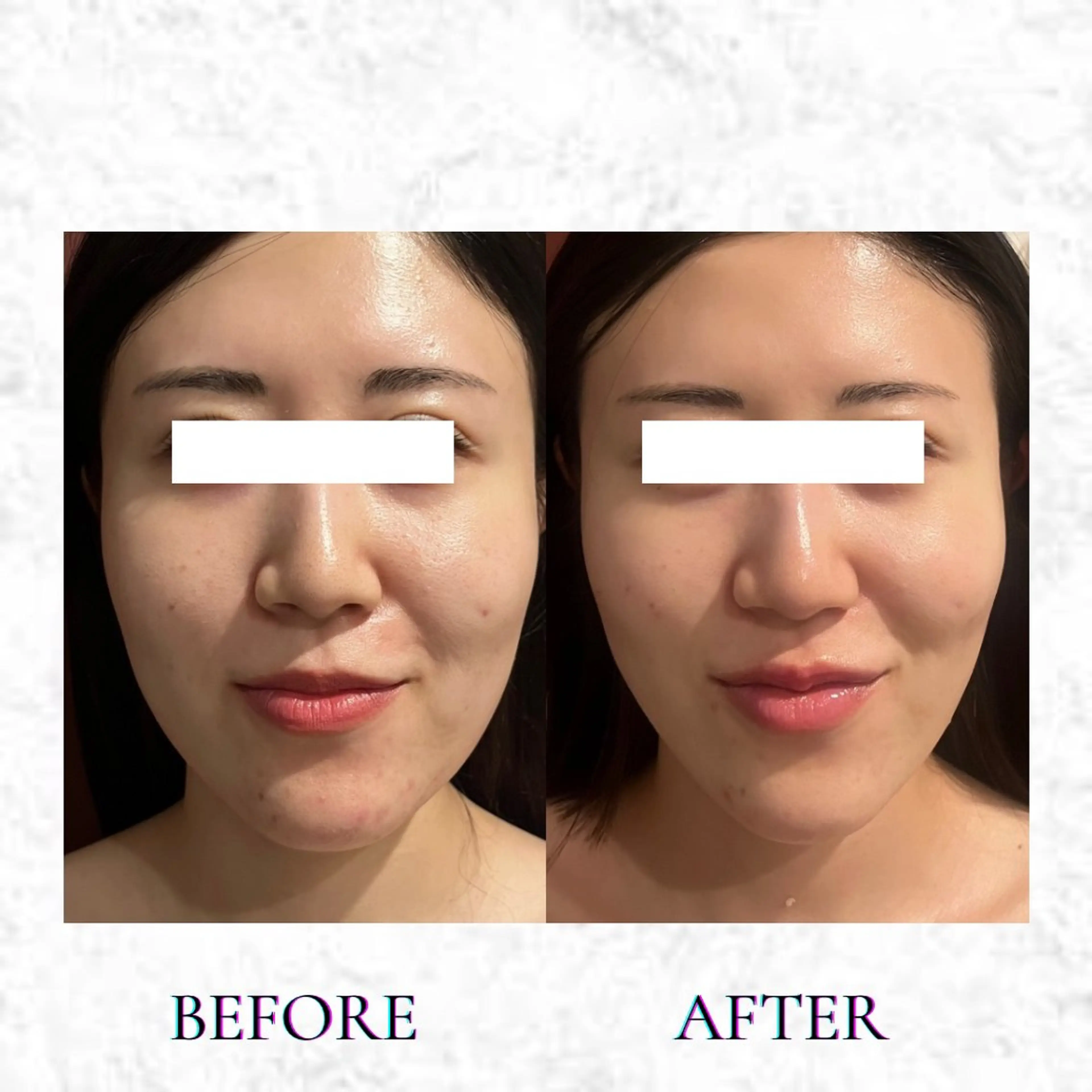 Beauty Max Astudioのその他イメージ