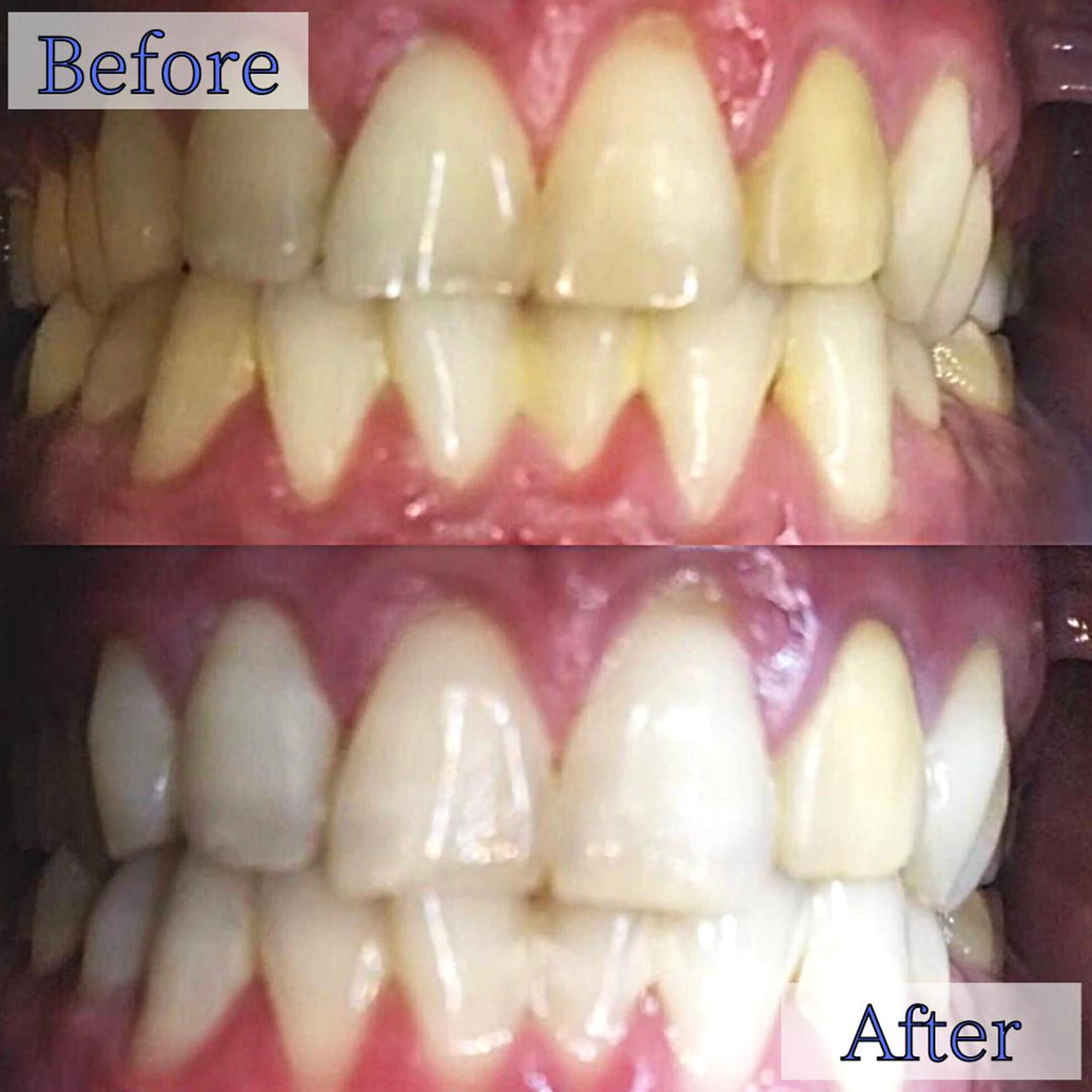 LBSホワイトニング 新宿店💎店長のエステ・リラクイメージ