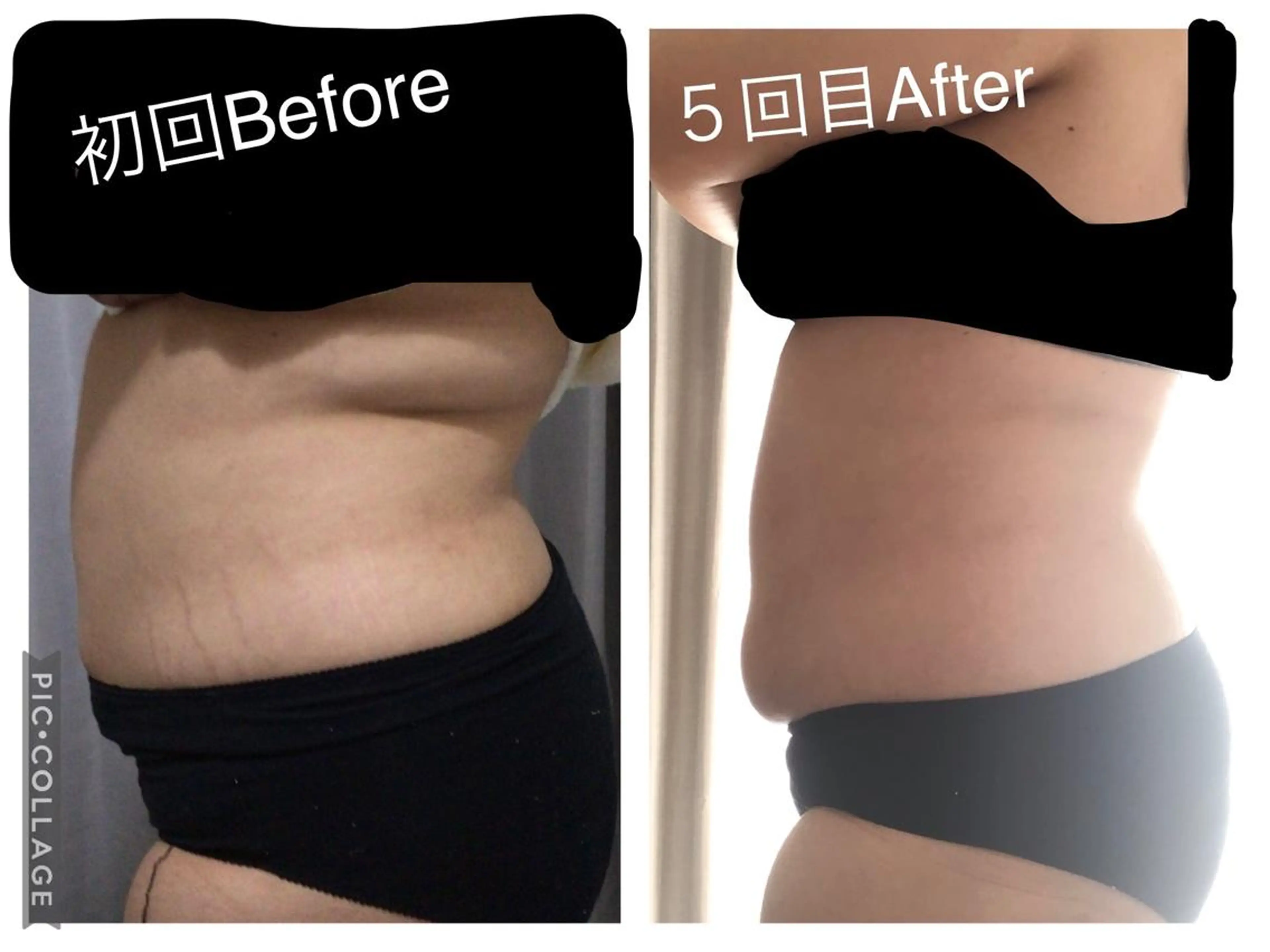 子宮矯正/腸揉み/ シュガーリング脱毛のエステ・リラクイメージ