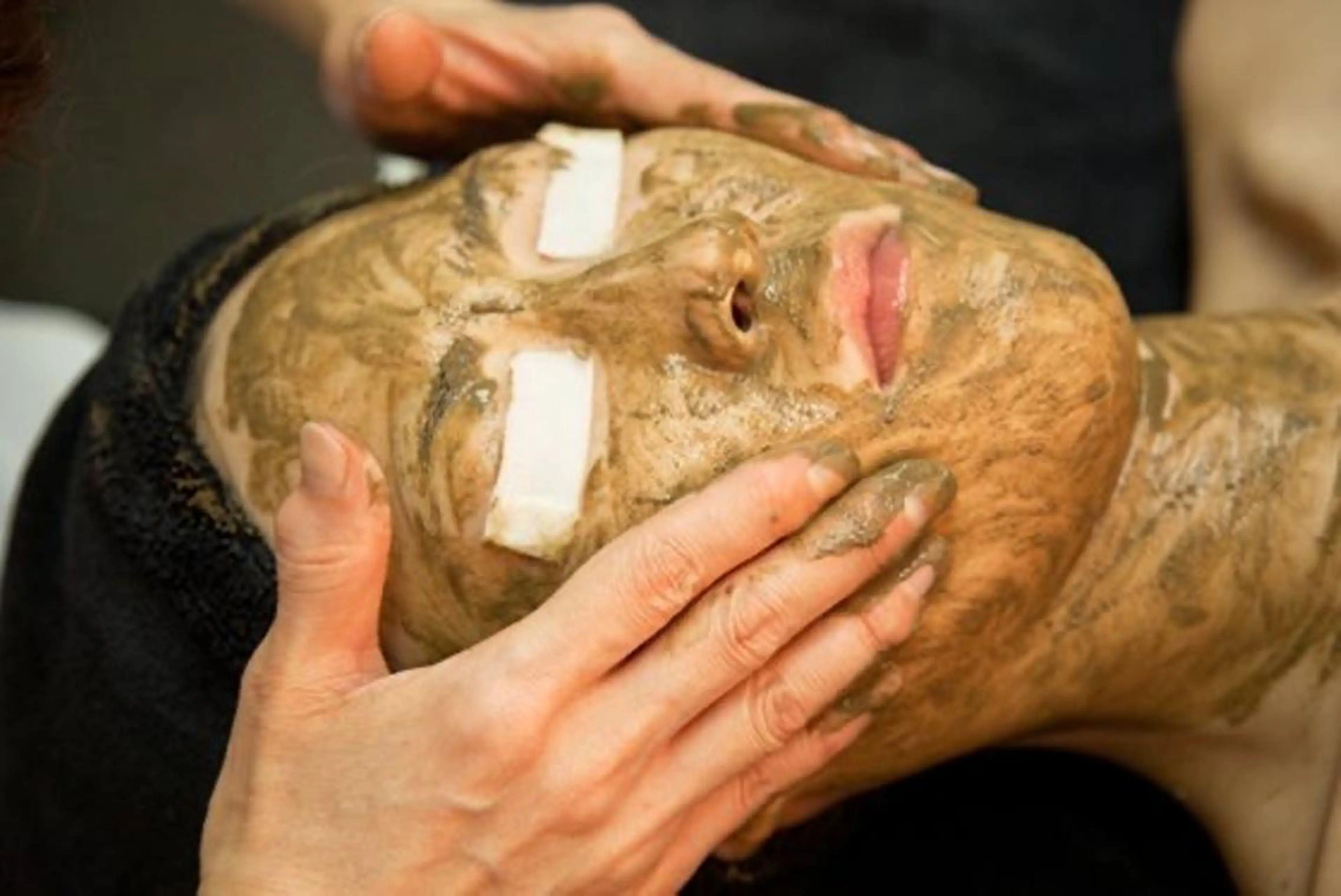 【✨剥離あり✨ハーブピーリング】🍃肌質を変えたい方必見🌿毛穴/ニキビ/ニキビ跡/シミ💖陶器トリートメント💓の写真