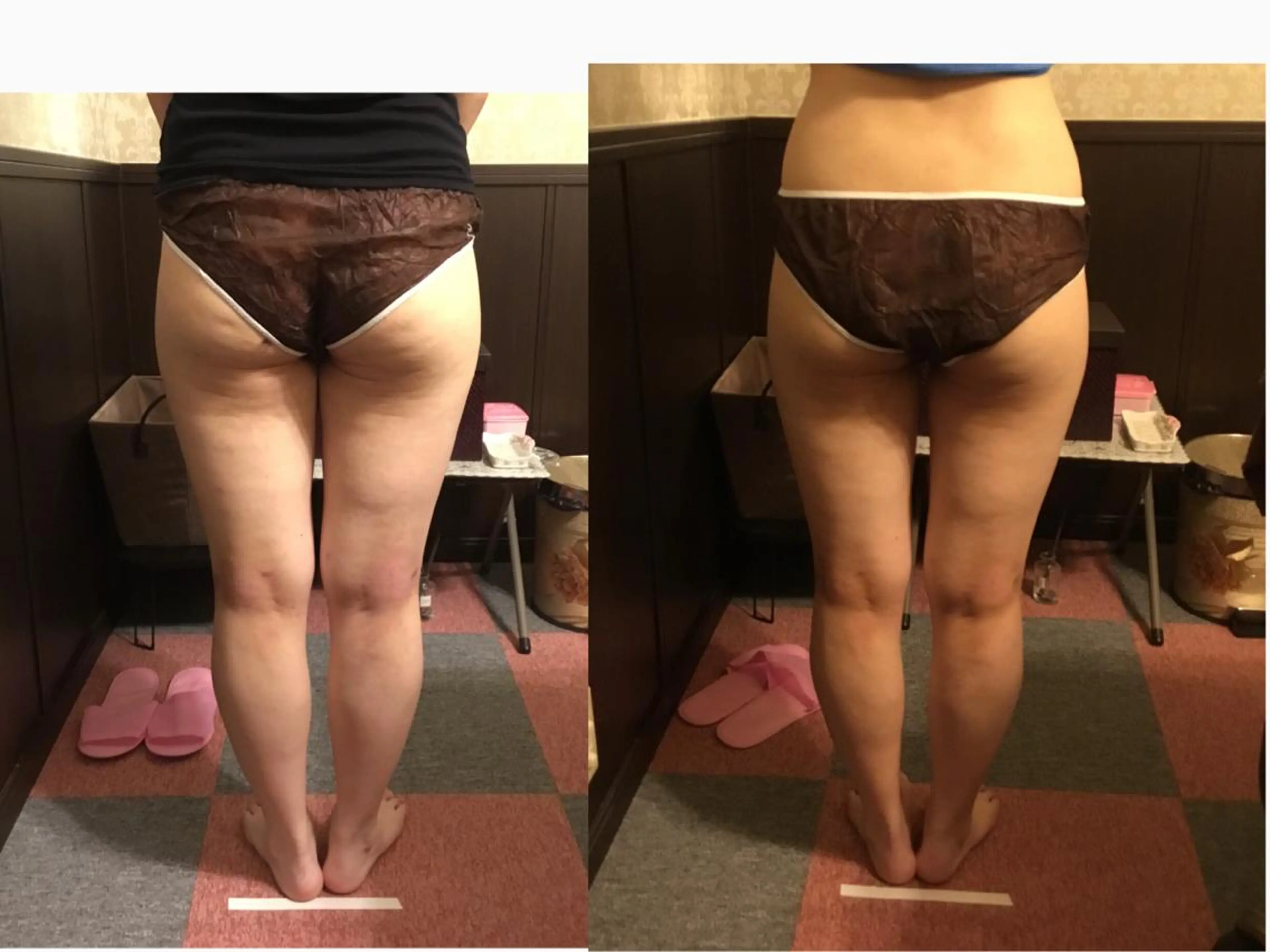 エステ リラク エステティックサロン 凜のエステ・リラクイメージ