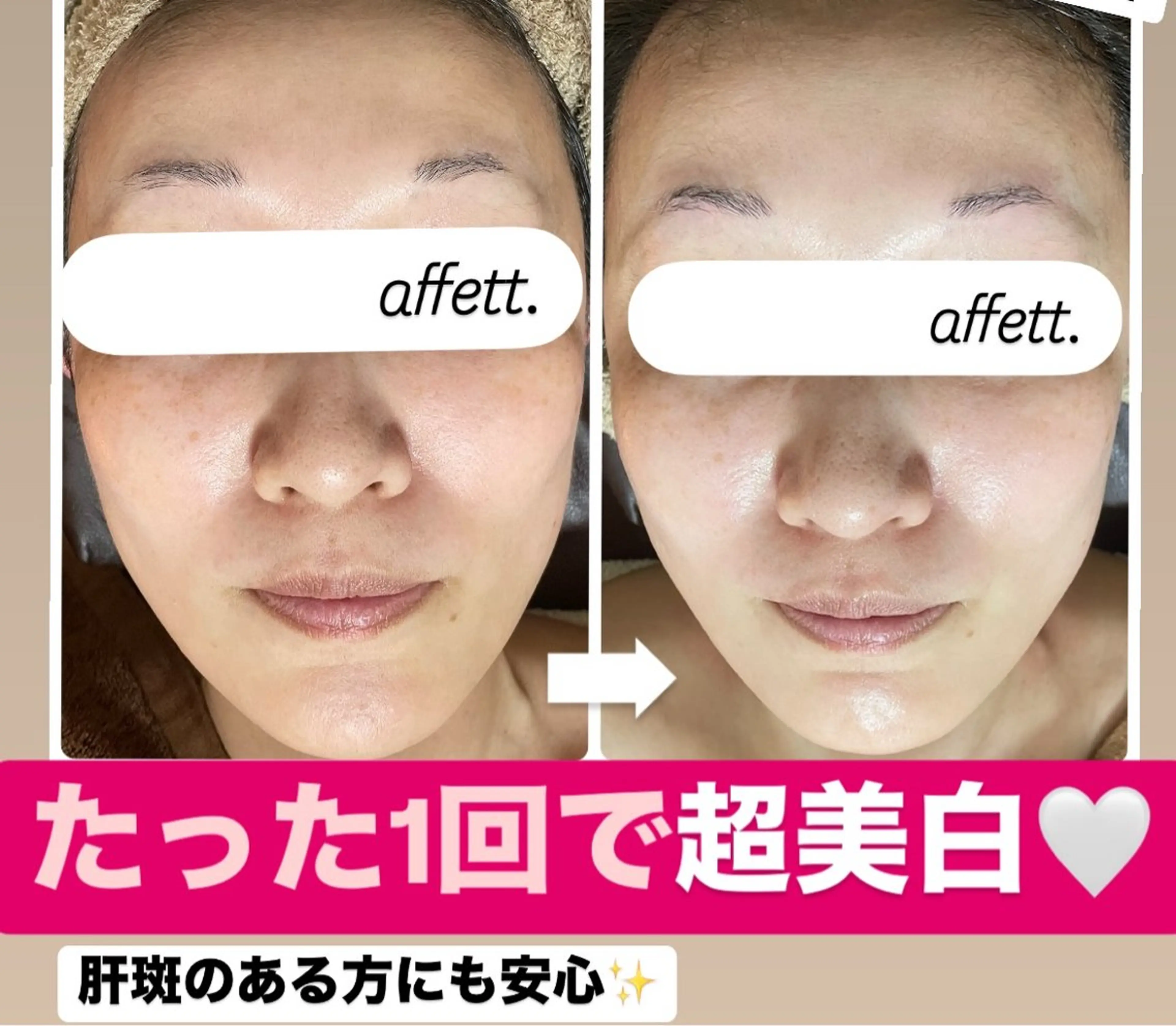 エステ 澤井 千晴のエステ・リラクイメージ