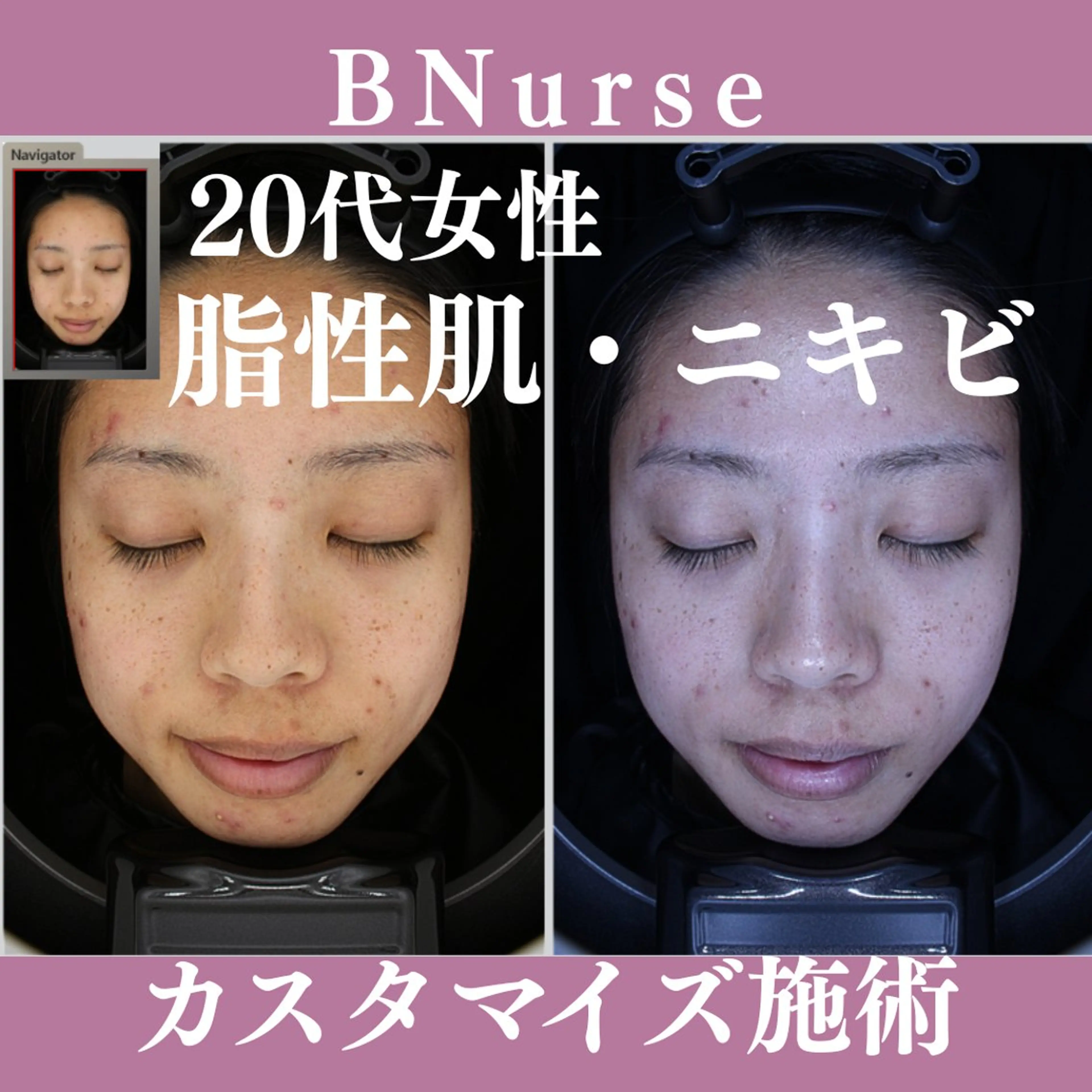 ミディアム 美容看護師専属担当制 医学に基づく肌管理のエステ・リラクイメージ