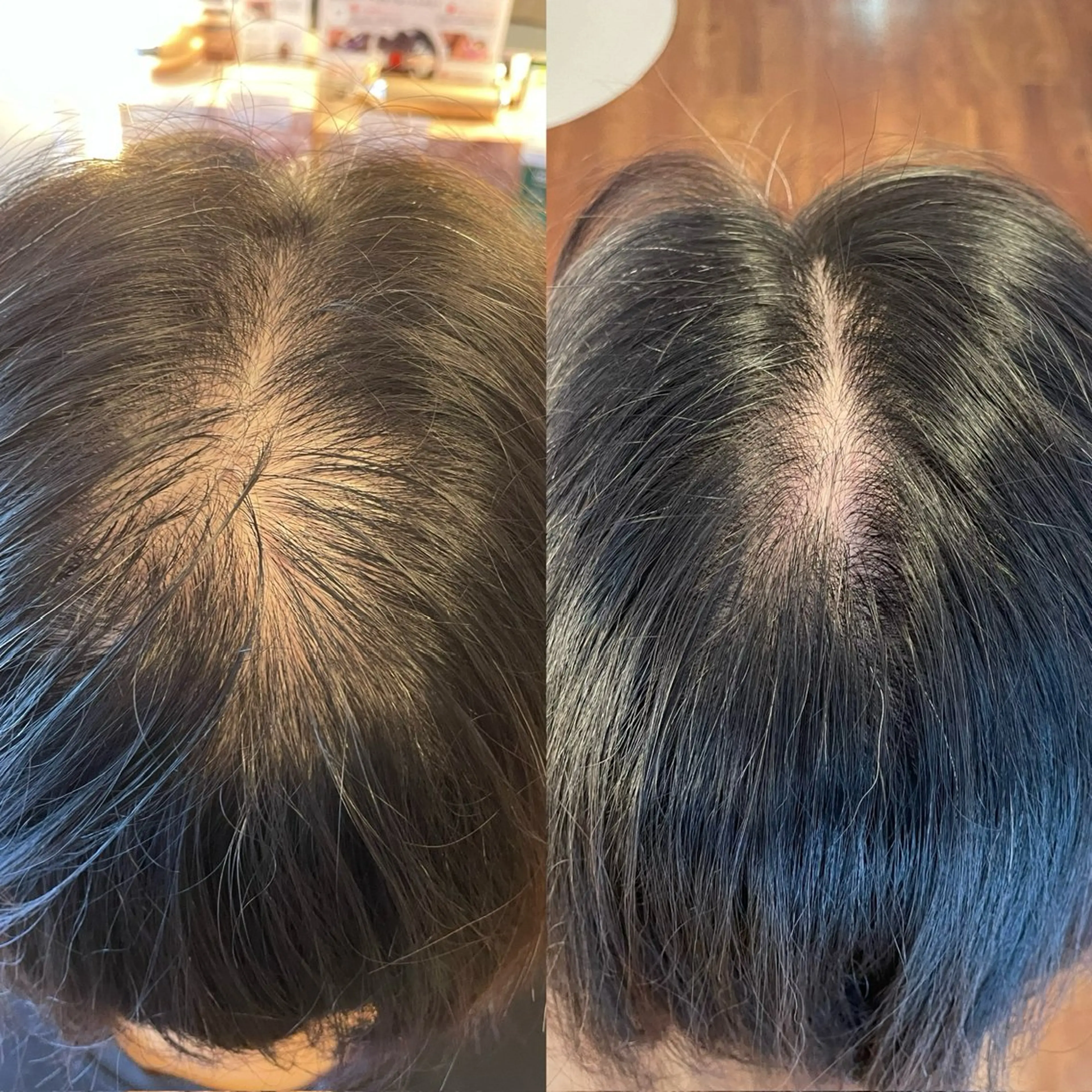 その他 毛穴・頭皮 専門店💪のその他イメージ