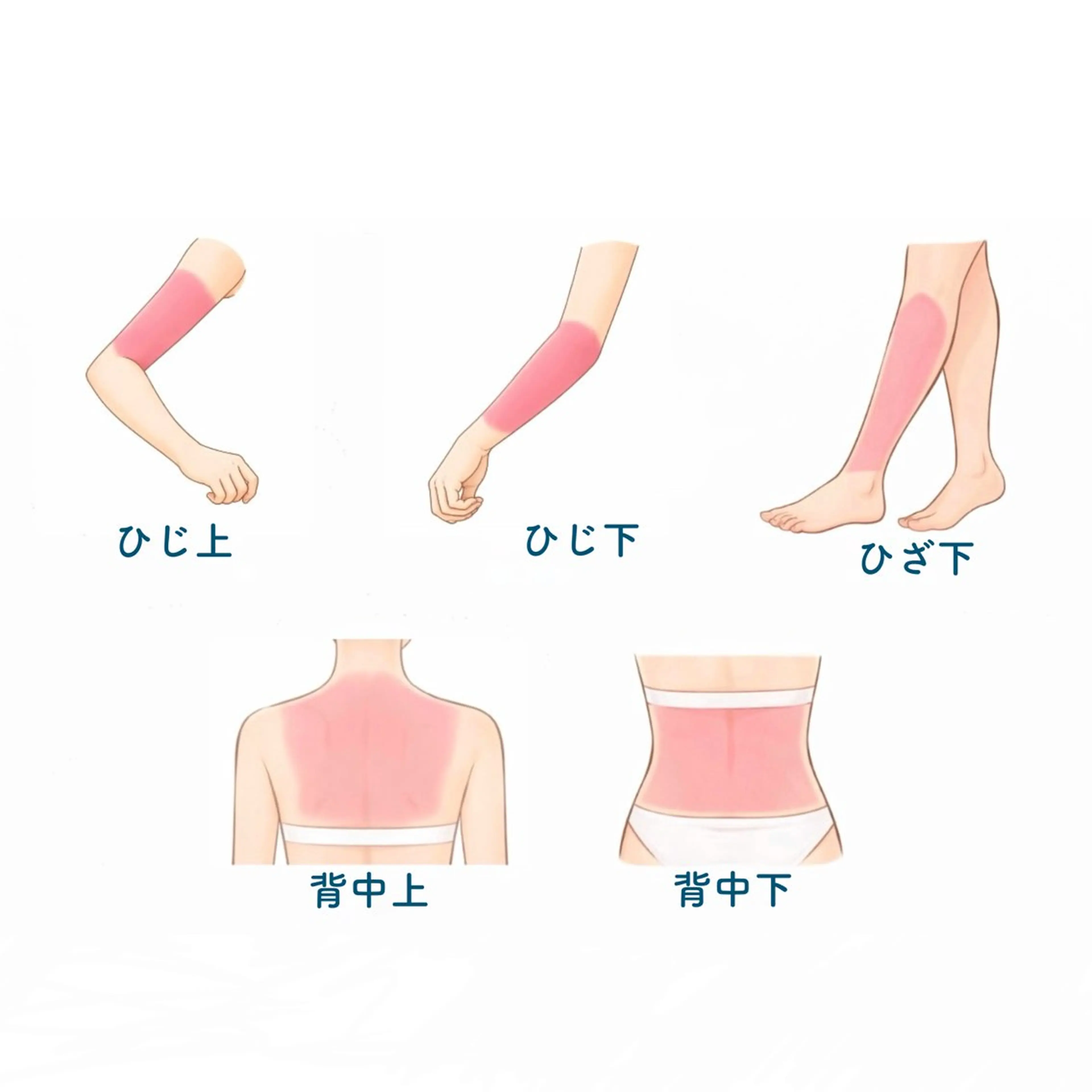 《女性限定》高速脱毛Lパーツ(1箇所選択)🧖🏻‍♀️の写真