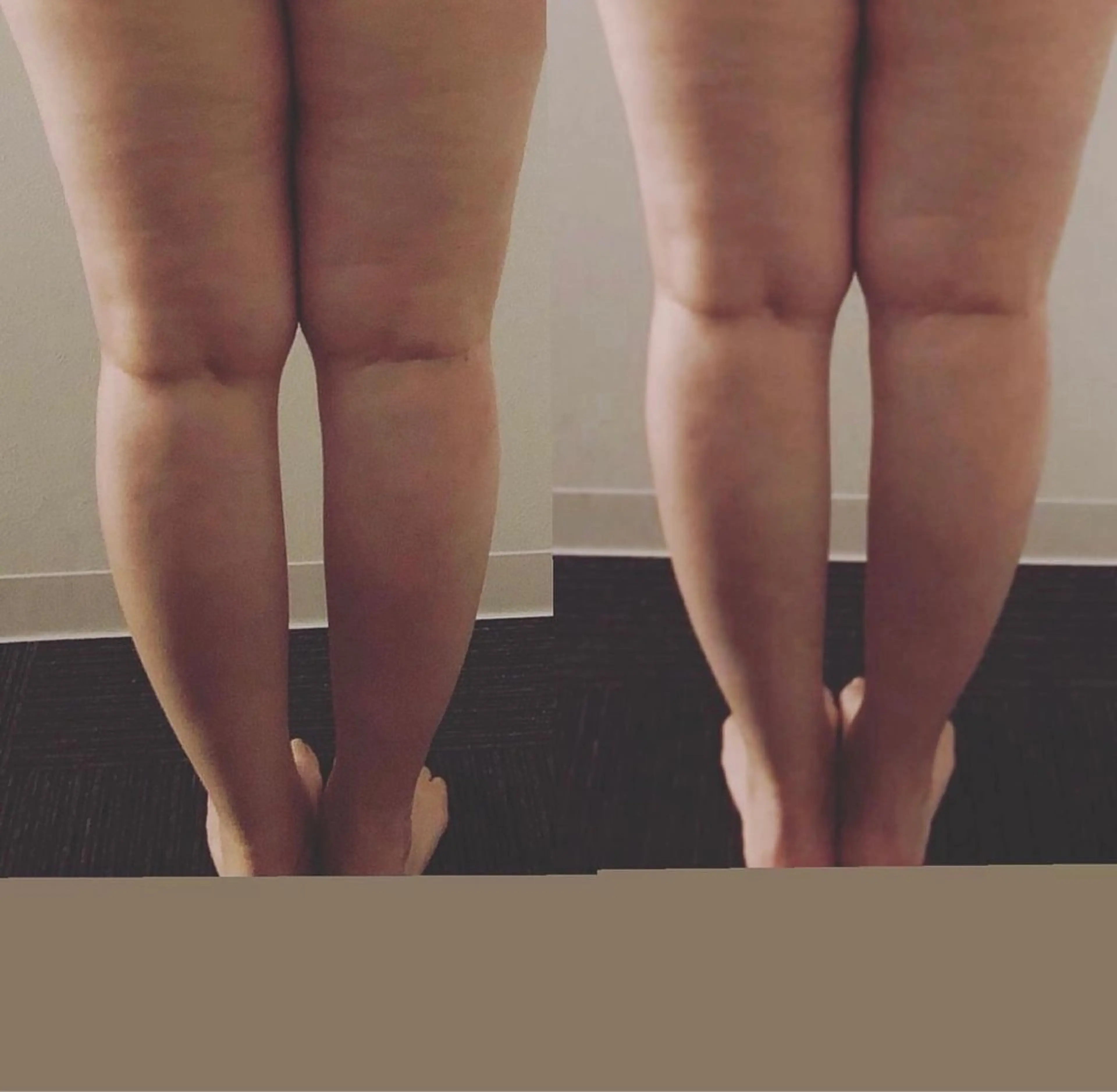 BESTUP 岐阜店のエステ・リラクイメージ