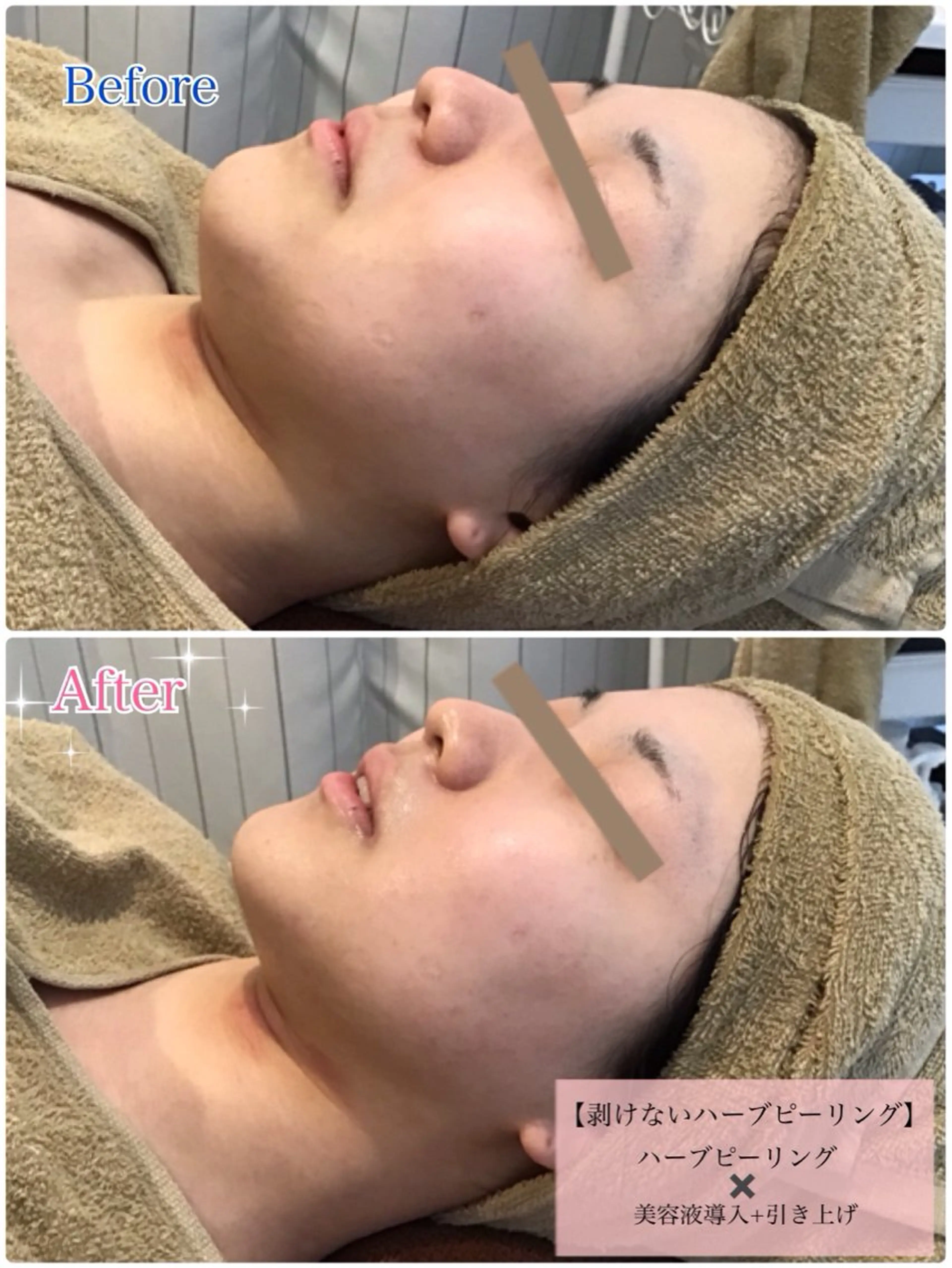 ローズハニー 小田原店のエステ・リラクイメージ