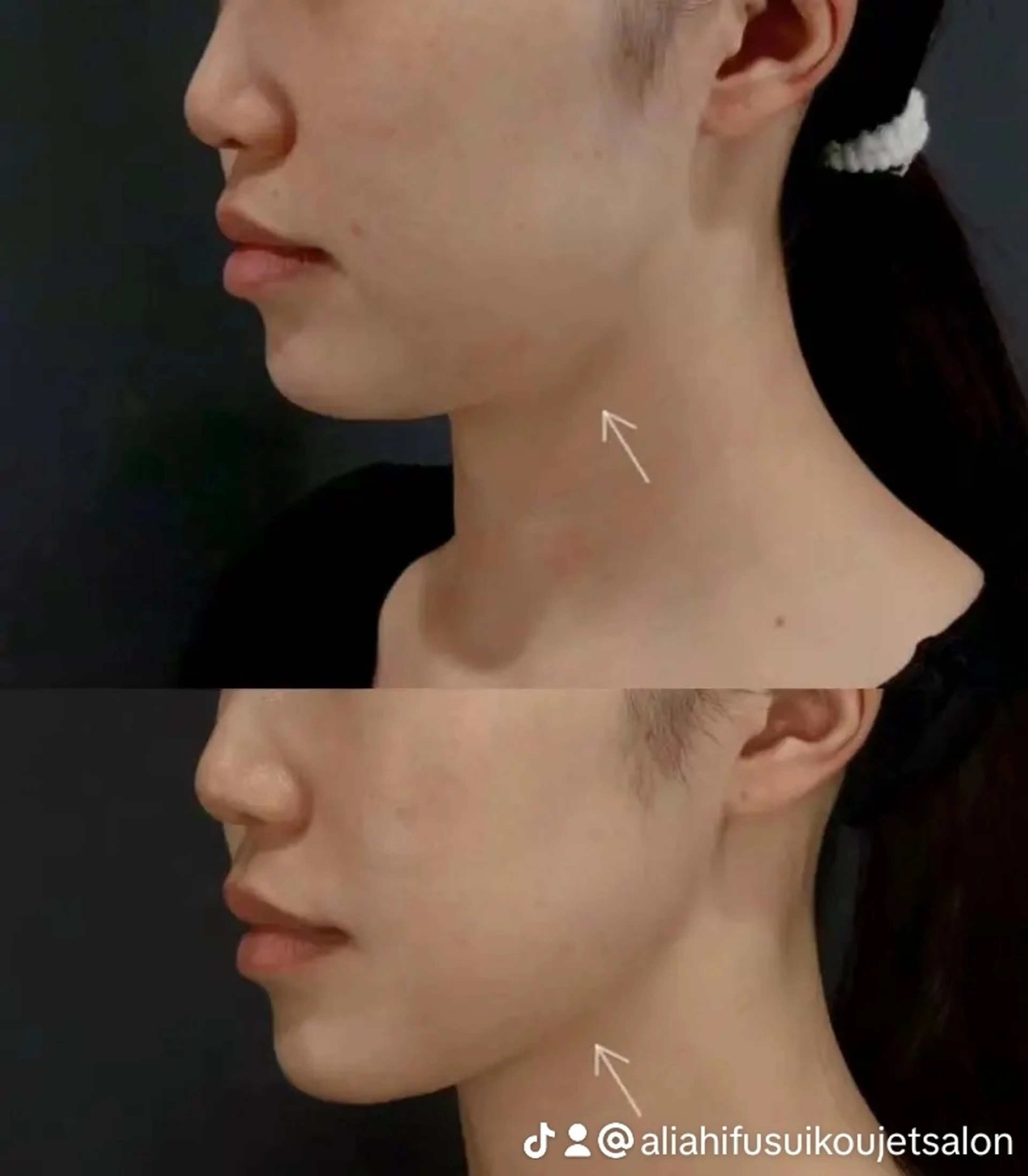 マツエク・マツパ 結婚式・ブライダル aliaハーブ水光店 エステティシャン募集のエステ・リラクイメージ