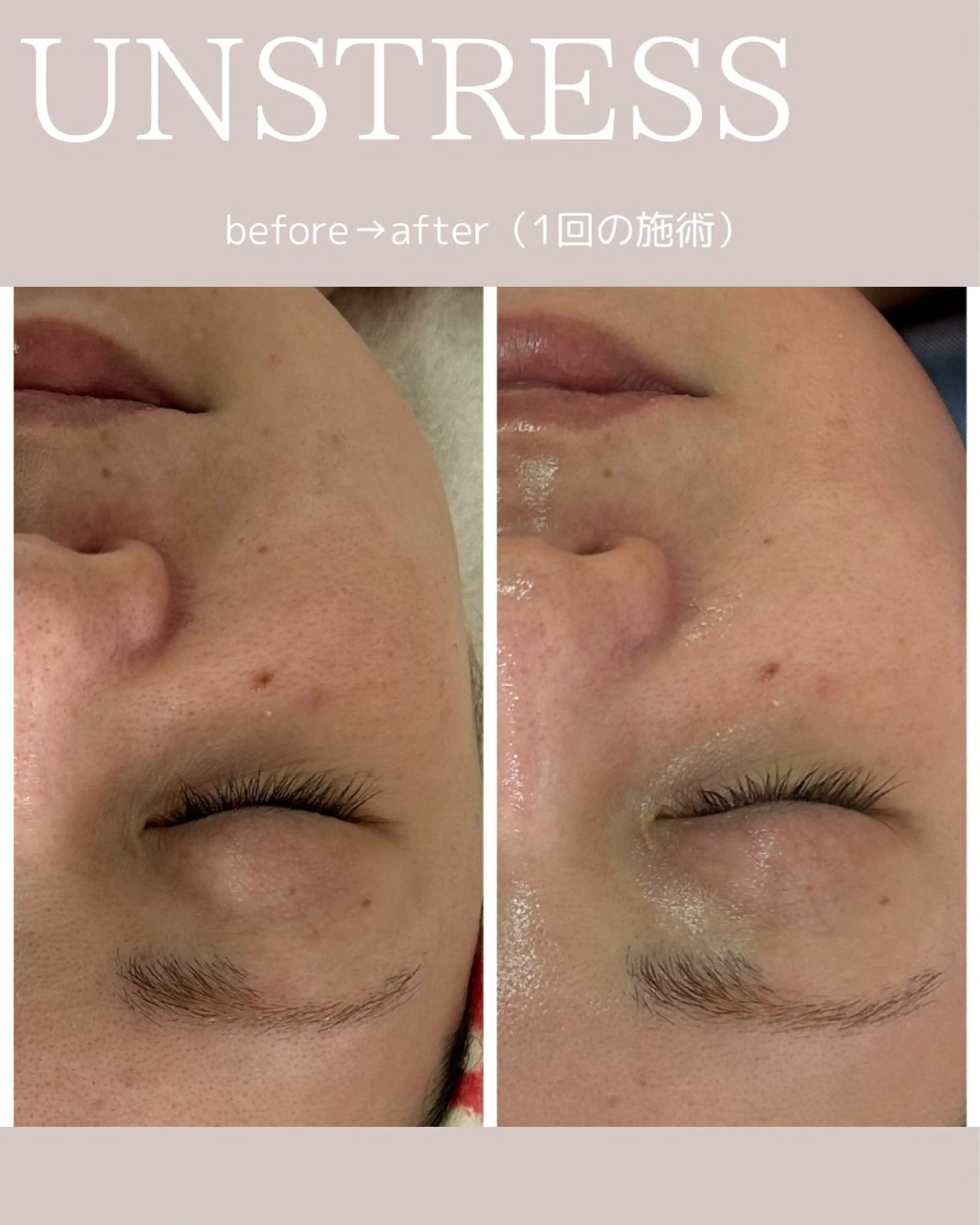 松尾 佳奈のエステ・リラクイメージ