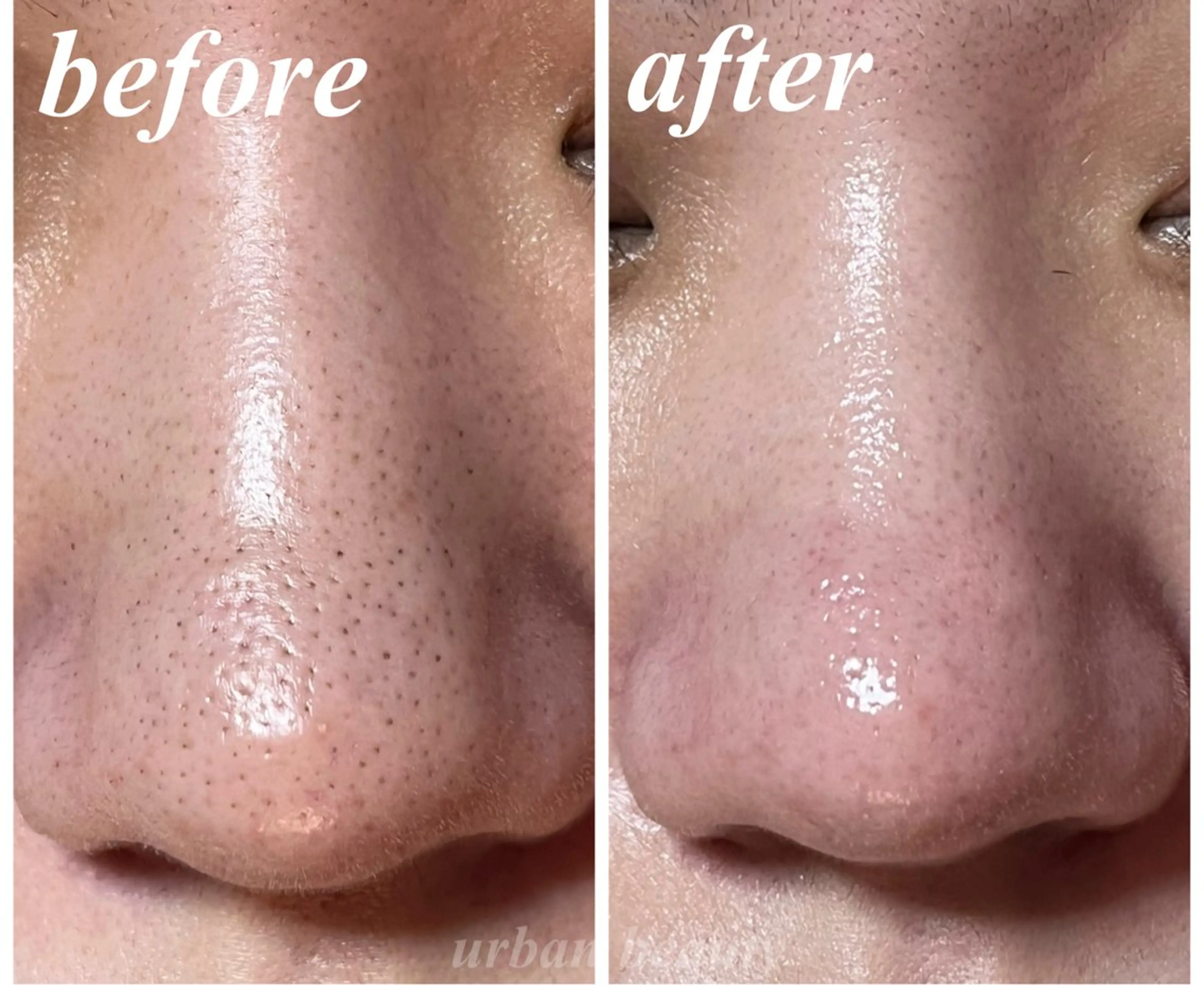 エステ リラク 結果重視｜毛穴エステ ｜友綱理恵のエステ・リラクイメージ